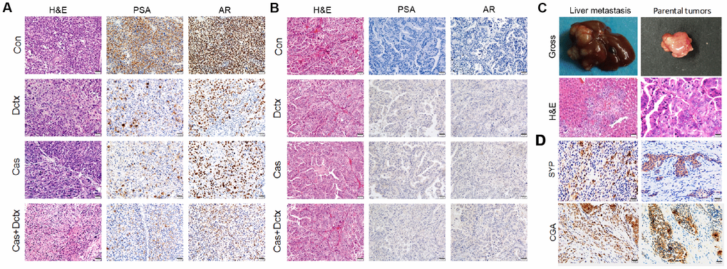 H&E staining and IHC analysis of different treatment groups. Results of H&E staining and IHC analysis in the different treatment groups in the (A) D17225 and (B) B45354 PDX model. (C) Representative images of liver metastasis and the parental tumors after treatment with docetaxel in the B45354 PDX model. (D) Expression of neuroendocrine carcinoma markers SYP and CGA after treatment with castration + docetaxel in the B45354 PDX model.