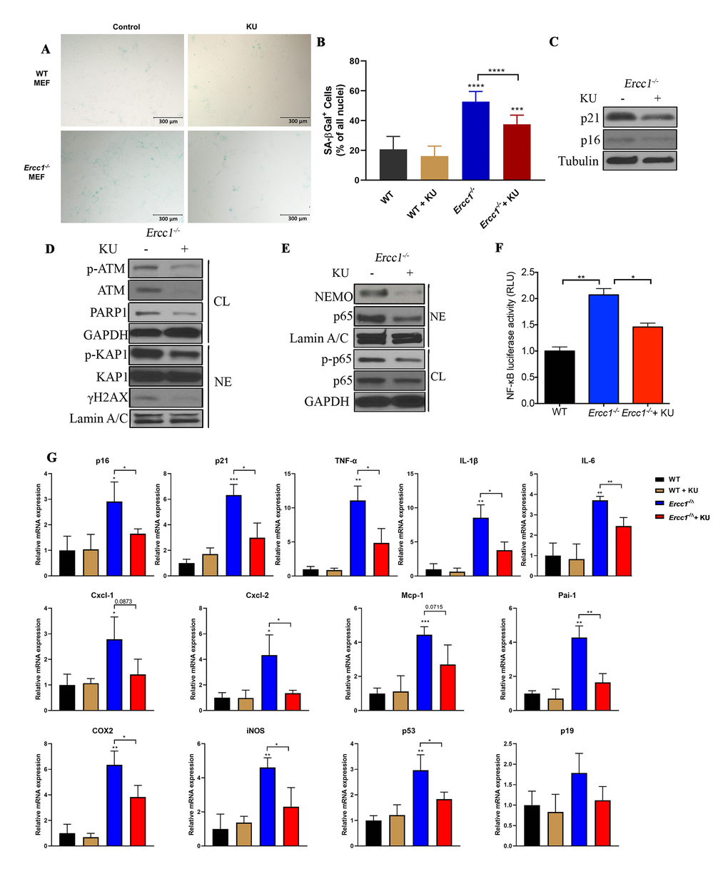 Pharmacologic inhibition of ATM rescues oxidative stress-induced senescence by suppressing ATM- and NEMO-mediated NF-κB activation. (A) Representative images of primary WT and Ercc1-/- MEFs were induced to undergo senescence by serial passaging at 20% oxygen. At passage 5, MEFs were grown in the presence or absence of KU-55933 (10 μM) for 72 hrs. Senescence was determined by SA-βgal staining. Images were obtained at the magnification of 10x. (B) Quantitation of the percent SA-βgal positive cells. Graph represents the mean +/- s.e.m. of three independent experiments. Student’s t-test, ***p C) Passage 5 Ercc1-/- MEFs treated with vehicle or KU-55933 (10 μM) for 72 hours were collected and levels of p21 and p16INK4a were determined by western blotting. (D) Passage 5 Ercc1-/- MEFs were treated with KU-55933 (10 μM) for 72 hours and whole cell lysate (CL) and nuclear extracts (NE) were analyzed by immunoblotting for expression of proteins involved in the DNA damage response. (E) Whole cell lysate (CL) and nuclear extract (NE) were extracted from Ercc1-/- MEFs treated with 10 μM of KU-55933 for analysis of nuclear NEMO and p65. GAPDH was used as a loading control of total proteins and LaminA/C as a loading control of nuclear protein. (F) Passage 5 WT and Ercc1-/- MEFs transfected with a NF-κB-luciferase reporter construct were cultured in the presence or absence of KU-55933 (10 μM) and were collected for luciferase assays after 72 hours. (G) qRT-PCR analysis of mRNA expression in passage 5 WT and Ercc1-/- MEFs treated with or without of KU-55933 (10 μM) for 72 hrs. P values were determined using a Student’s t-test. *p