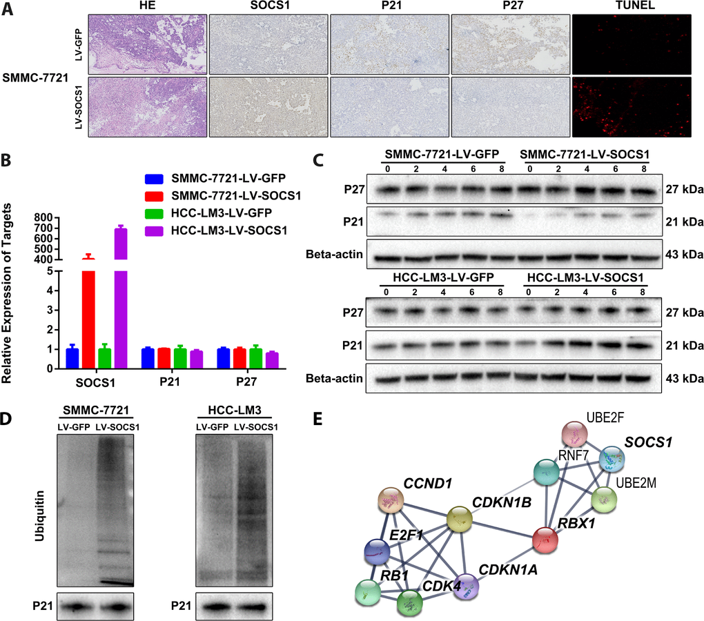 SOCS1 overexpression degraded P21 via ubiquitin. (A) Histochemical staining and TUNEL detection of tumour-bearing tissues in nude mice. (B) The mRNA levels of P21 and P27 are not regulated by SOCS1. (C) The ubiquitin inhibitory effect of 20 μM MG-132 (a proteasome inhibitor) on SMMC-7721 and HCC-LM3 cells was observed at 2 hours, 4 hours, 6 hours and 8 hours. (D) Detection of the difference in ubiquitination of P21 after overexpression of SOCS1 by Co-IP. (E) Interaction network between SOCS1, ubiquitin proteins, cyclin proteins and cyclin-dependent kinases.