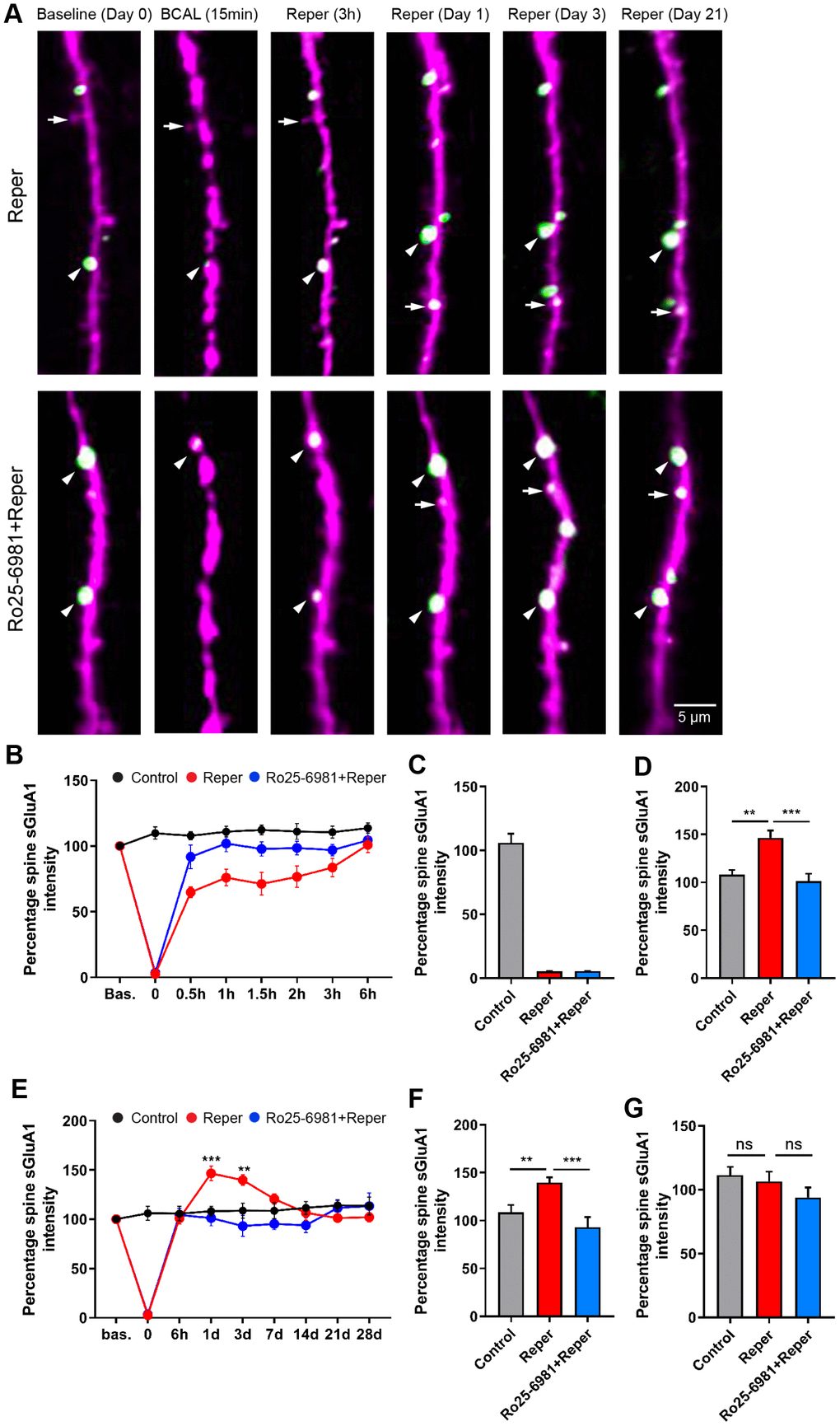 BCAL leads to an NMDAR-dependent increase in spine sGluA1 in vivo in apical dendrites of layer 2/3 neurons in the somatosensory cortex. (A) Representative images of spines on layer 2/3 apical dendrites in Reper or Ro25-6981 treated mice. Arrowheads indicate stable spines and arrows mark unstable spines, including new spines and eliminated spines. (B, E) The overall trend of the Spine sGluA1 intensity in control, Reper and Ro25-6981-treated mice before and after 6 hours (B) and 28 days (E) of ischemia-reperfusion. **P P C–G) Percentage spine sGluA1 at the beginning of reperfusion (C), on the first day (D, n= 425 spines in 5 control mice, n= 379 spines in Reper mice, and n= 411 spines in 5 Ro25-6981-treated mice.), the 3rd day (F, n= 410 spines in 5 control mice, n= 283 spines in Reper mice, and n= 274 spines in 5 Ro25-6981-treated mice.) and the 14th day (G, n= 410 spines in 5 control mice, n= 283 spines in Reper mice, and n= 274 spines in 5 Ro25-6981-treated mice.) following ischemia-reperfusion. **P P 