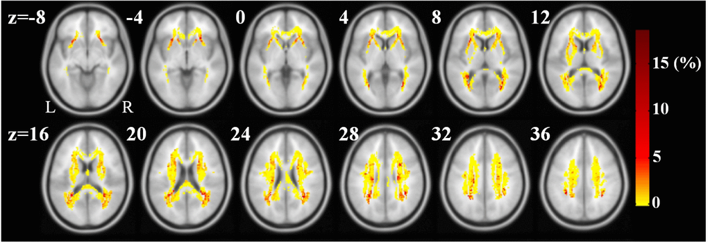 Weight maps in the RVR-ANIMALS model. Only voxels with positive weights and overlapping with JHU white-matter atlas are presented. The redder the color, the larger the weight of the voxel.