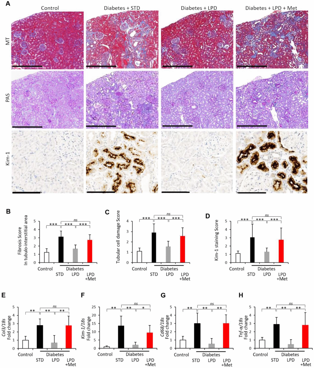 Changes in renal fibrosis and tubular cell damage. Representative photographs of MT, PAS staining and Kim-1 immunohistochemistry of the kidney after the intervention. MT staining of the tubulointerstitial area (scale bar: 500 μm), PAS staining for the evaluation of tubular cell damage (scale bar: 500 μm) and immunohistochemistry for Kim-1 (scale bar: 100 μm) at the end of the study (A); Tubulointerstitial fibrotic scores obtained using MT staining (B) (n=7); tubular cell damage scores obtained using PAS staining (C) (n=7); semiquantitation of Kim-1 staining scores (D) (n=3); mRNA expression of Col3 (E), Kim-1 (F), Cd68 (G) and Tnf-α (H) adjusted to 18S levels, in the renal cortex at the end of the study (n=7). The data shown are the means ± SD. *pns: not significant. MT: Masson’s trichrome, PAS: Periodic Acid Schiff, Col3: type 3 collagen, Kim-1: kidney injury molecule-1, Tnf-α: tumor necrosis factor-α.