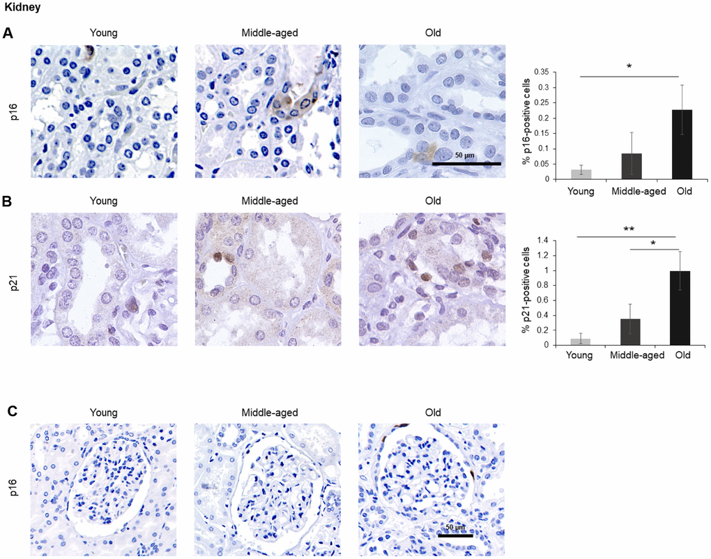 Kidney. (A, B) Cells expressing p16 (A) or p21 (B) were identified by IHC staining in the renal cortex of kidney of Young, Middle-aged, and Old donors. (C) Decreased magnification images showing p16-positive cells in the Bowman capsule of Old donors. Graphs represent the quantification (%) of p16-positive (A) and p21-positive (B) cells from 5 tissue cores from independent donors per organ and age group; data represent the means ±SD from 5 different donors. p values were determined by one-way ANOVA with Tukey adjustments for multiple comparisons where appropriate. **, p p 