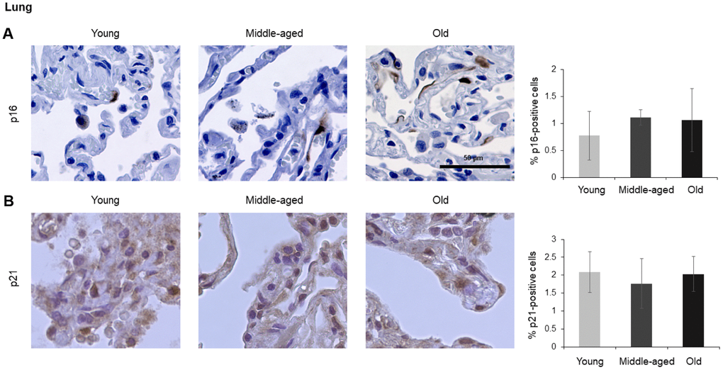 Lung. Cells expressing p16 (A) or p21 (B) were identified by IHC staining in the lung from Young, Middle-aged, and Old donors. Graph represents the quantification (%) of p16-positive cells (A) and p21-positive cells (B) from 5 tissue cores from independent donors per organ and age group; data represent the means ±SD from 5 different donors.