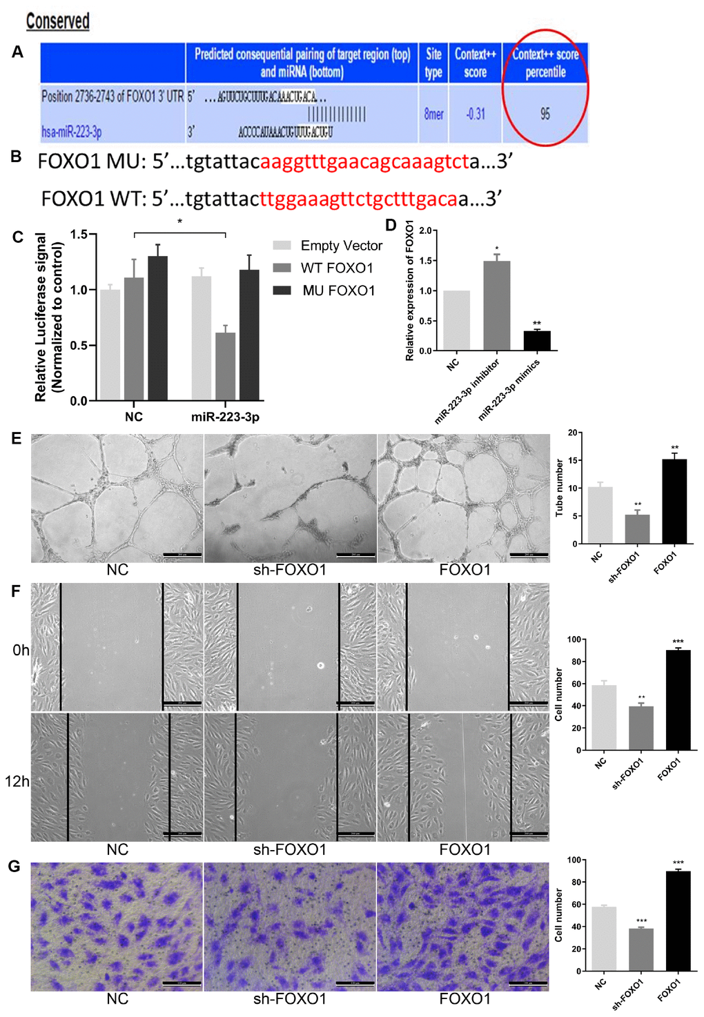 FOXO1 acted as the direct target of miR-223-3p. (A) Bioinformatics programs assay revealed complementary binding within miR-223-3p and FOXO1 3’UTR. (B) The luciferase reporter constructs containing WT-FOXO1 or MU-FOXO1 sequence. (C) Dual-luciferase reporter assay verified the targeting relationship between miR-223-3p and FOXO1. (D) Relative quantification of mRNA levels of FOXO1. Three independent experiments were performed. (E) Tube formation assay showing the angiogenesis ability of EPCs by FOXO1 knockdown and overexpression. Scale bar=200μm. (original magnification, ×100). FOXO1 knockdown and overexpression, respectively, repressed and enhanced capability of angiogenesis in EPCs. (F) Effects of FOXO1 on cell migration were analysed by wound healing assay. Scale bar=200μm. (original magnification, ×100). FOXO1 knockdown and overexpression, respectively, reduced and increased number of EPCs migrated. (G) Transwell invasion assay showed that FOXO1 knockdown and overexpression, respectively, inhibited and promoted the ability of cell invasion in EPCs. Scale bar=100μm. (original magnification, ×200). **P 