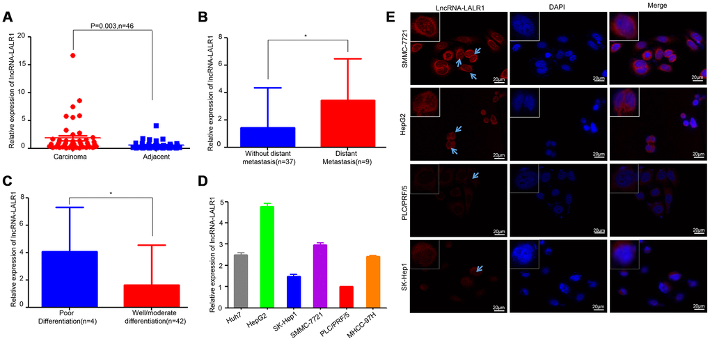 LncRNA-LALR1 is highly expressed in HCC samples. (A) qRT-PCR assay showing the expression of lncRNA-LALR1 in HCC tissues and matched non-tumor tissues. (B) The expression of lncRNA-LALR1 in tumor samples from HCC patients with distant metastasis. (C) The expression of lncRNA-LALR1 in tumor samples from HCC patients with poor differentiation (D) qRT-PCR assay showing the expression of lncRNA-LALR1 in six HCC cell lines. (E) Fluorescence in situ hybridization (FISH) assay showing the localization of lncRNA-LALR1 in HCC cells. *: P 