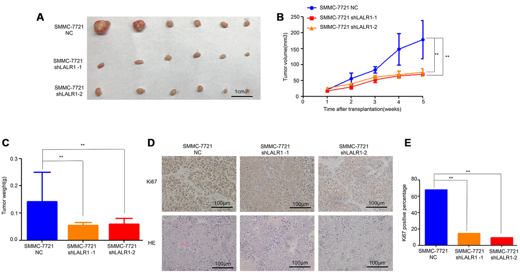 Knock-down of lncRNA-LALR1 inhibits growth of HCC cells in vivo. (A) The tumor volumes after knockdown of lncRNA-LALR1. (B) Knockdown of lncRNA-LALR1 decreases tumor volumes. (C) Knockdown of lncRNA-LALR1 decreases tumor weights. (D) Immunohistochemistry showing lncRNA-LALR1 silencing leads to a reduce of Ki67 protein levels. (E) LncRNA-LALR1 silencing reduces Ki67 protein levels. *: P 