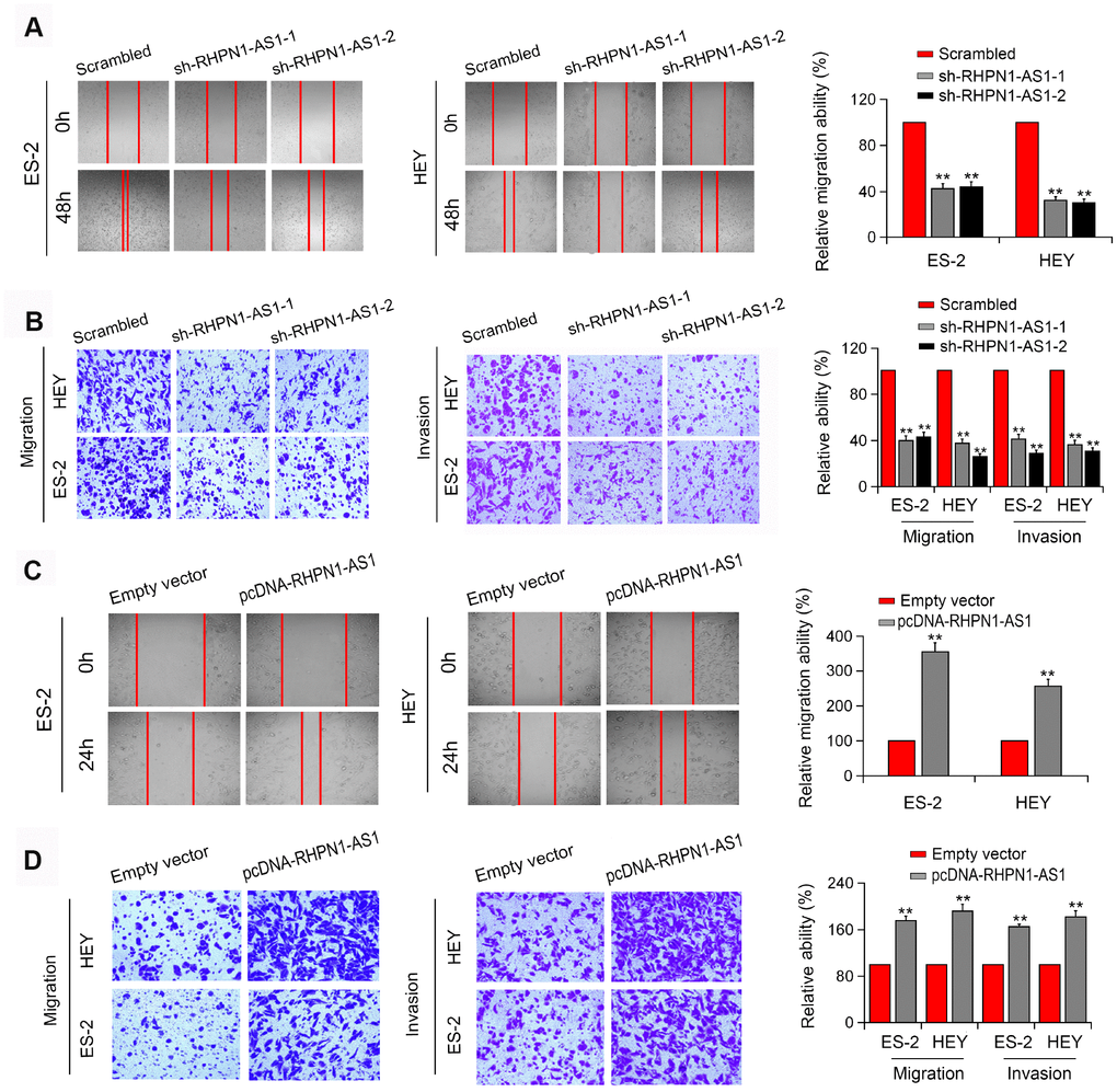 RHPN1-AS1 enhances EOC cell migration and invasion. (A, B) Wound healing assay and Transwell assay of ES-2 and HEY cells transfected with sh-RHPN1-AS1s. (C, D) Wound healing assay and Transwell assay of ES-2 and HEY cells transfected with pcDNA-RHPN1-AS1. *P