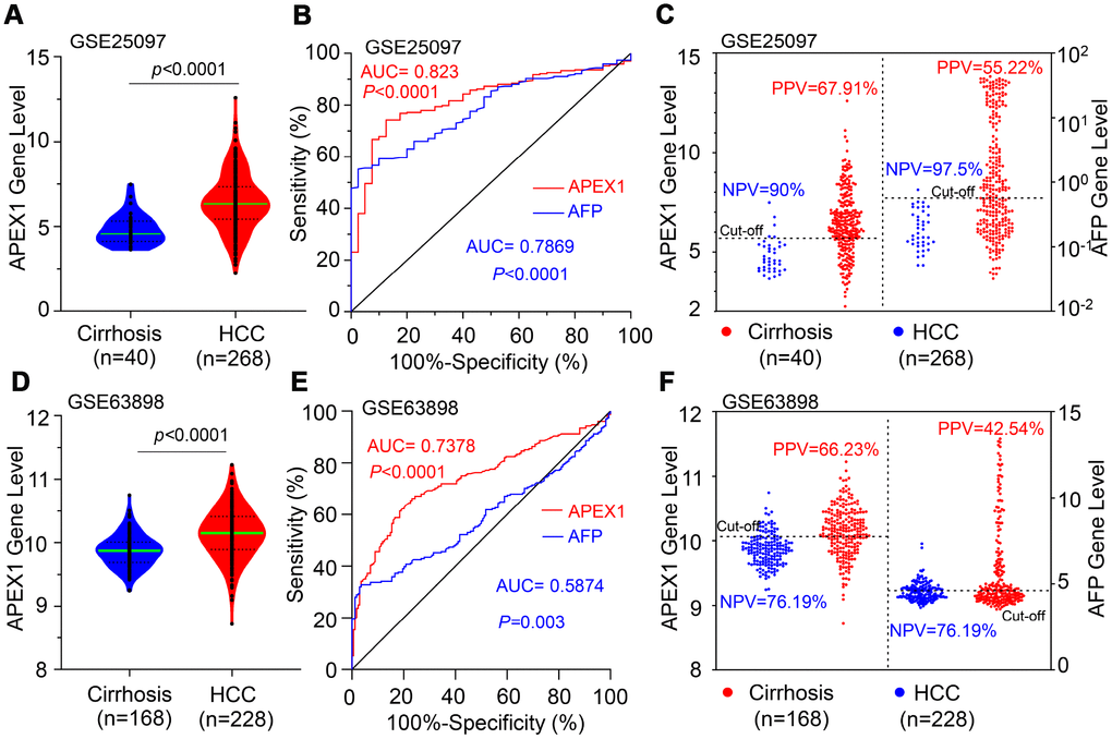 APEX1 shows a higher positive predictive value than AFP in HCC patients. (A) The histogram plot shows APEX1 mRNA levels in patients with liver cirrhosis (n=40) and HCC (n=268) from the GSE25097 dataset. (B) ROC curve analysis shows the diagnostic value of APEX1 and AFP in liver cirrhosis and HCC patients from the GSE25097 dataset. (C) The optimal cut-off value for APEX1 and AFP in liver cirrhosis and HCC patients was determined according to the Youden and Product indices. Also shown are the positive predictive value (PPV) and negative predictive value (NPV) for APEX1 and AFP. (D) The histogram plot shows relative APEX1 mRNA levels in patients with liver cirrhosis (n=168) and HCC (n=228) from the GSE63898 dataset. (E) ROC curve analysis shows the diagnostic values of APEX1 and AFP in the liver cirrhosis and HCC patients from the GSE63898 dataset. (F) The optimal cut-off values for APEX1 and AFP in the liver cirrhosis and HCC patients was determined according to the Youden and Product indices. Also shown are the PPV and NPV for APEX1 and AFP.