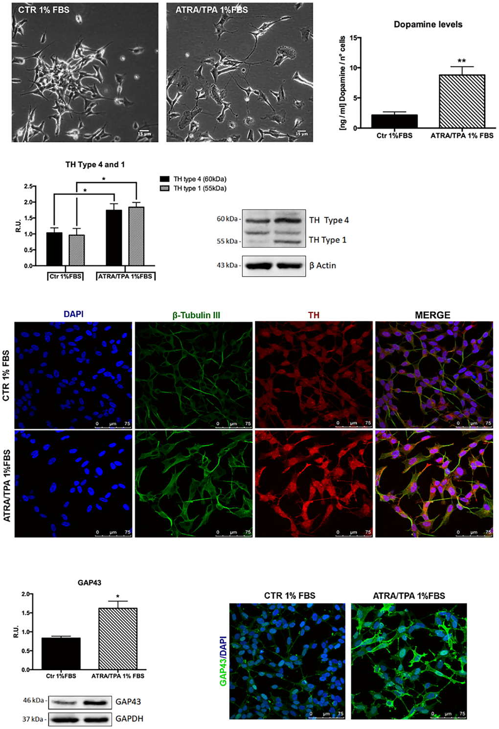 Dopaminergic phenotype of SH-SY5Y neuroblastoma cells. Contrast phase microscopy of differentiated with ATRA/TPA and not differentiated SH-SY5Y cells and histogram showing dopamine production. Western blotting for TH. Immunofluorescence of β-tubulin III and TH. Western blotting and immunofluorescence for GAP43. Results are mean ± SE of 3 different experiments (n=3). *p