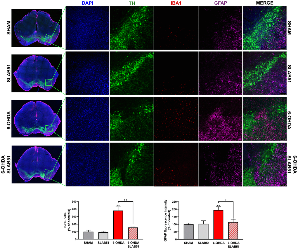 Triple immunostaining at 20x magnification for Iba1, TH and GFAP, nuclei were counterstained with DAPI. On the left it is possible to appreciate mosaic figures, while on the right inset at higher magnification for TH, Iba1 and GFAP staining and merge figures were reported. Histograms for Iba1 show the number of Iba1 + cells, while for GFAP the fluorescence intensity, as % of controls, is plotted. ** p