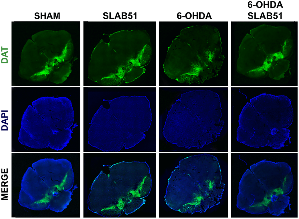 Immunofluorescence for DAT in mice Substantia nigra. Images were taken at confocal microscope at 20x magnification.