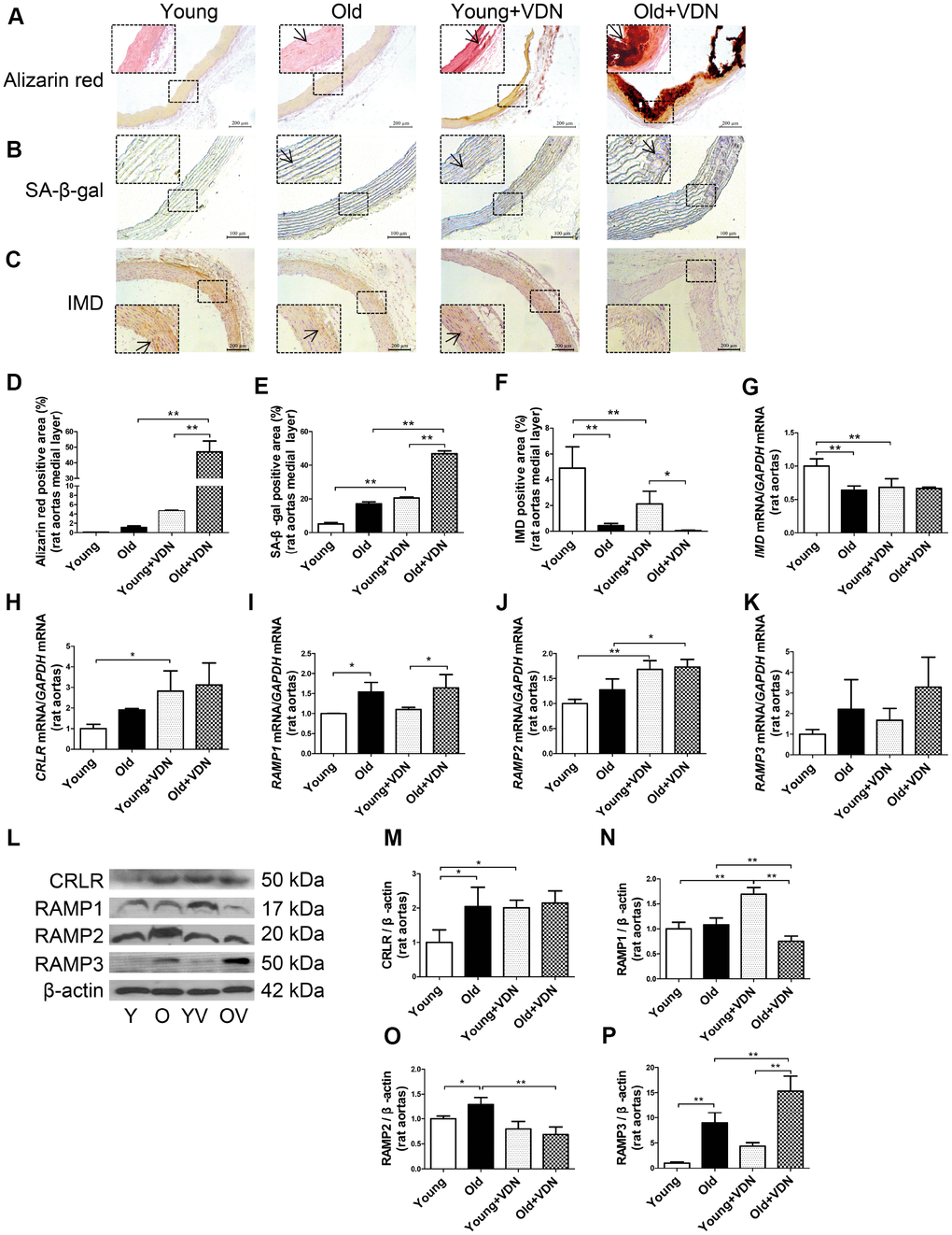 IMD and its receptor levels in aging-associated vascular calcification induced by VDN in rats. (A) Alizarin red staining for vascular calcium deposition (positive staining: red) (Scale bar=200 μm). (B) SA-β-gal staining for β-galactosidase activity (blue) (Scale bar=100 μm). (C) Immunohistochemistry staining for IMD (Scale bar=200 μm), and (D–F) quantification of (D) calcium deposition-positive staining (n=3), (E) β-galactosidase-positive staining (n=3) and (F) IMD-positive staining (n=4) in the medial layer of rat thoracic aortas. (G–K) Quantitative RT-PCR analysis of mRNA levels of IMD, calcitonin receptor-like receptor (CRLR), receptor activity-modifying protein 1 (RAMP1), RAMP2 and RAMP3 in rat aortas (n=3 in each group). (L) Western blot analysis of protein levels of CRLR and RAMP1, 2 and 3 in rat aortas and (M–P) quantification (n=3). The arrow indicates positive staining. Y=young rats. O=old rats. YV=young+VDN. OV=old+VDN. Data are mean ± SD. *PP