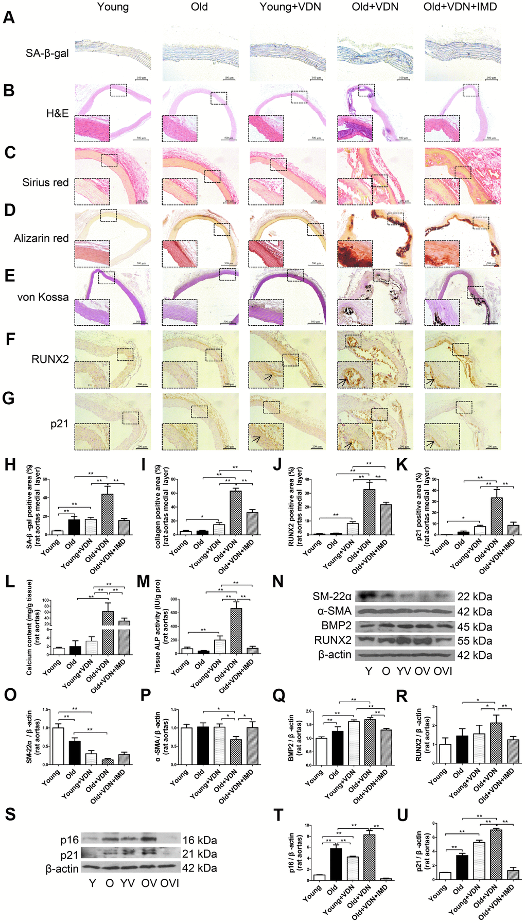 Exogenous IMD1-53 attenuated aging-associated vascular calcification in rats. (A) SA-β-gal staining for β-galactosidase activity (positive staining: blue) (Scale bar=100 μm), (B) H&E staining (Scale bar=500 μm), (C) Sirius red staining for collagen (red) (Scale bar=200 μm), (D) Alizarin red staining (red) (Scale bar=500 μm) and (E) von Kossa staining for vascular calcium deposition (black) (Scale bar=500 μm), (F) Immunohistochemistry staining for runt-related transcription factor 2 (RUNX2) (Scale bar=200 μm) and (G) cyclin-dependent kinase inhibitor p21 (Scale bar=200 μm), and (H–K) quantification of (H) β-galactosidase-positive staining (n=4), (I) collagen-positive staining (n=4), (J) RUNX2-positive staining (n=4), and (K) p21-positive staining (n=4) in the medial layer of rat thoracic aortas. (L) Calcium content assay (n=6) and (M) alkaline phosphatase (ALP) activity assay (n=6) in rat aortas. (N) Western blot analysis of protein levels of smooth muscle 22 alpha (SM-22α), alpha smooth muscle actin (α-SMA), bone morphogenetic protein 2 (BMP2) and RUNX2 in rat aortas, and (O–R) quantification (n=3). (S) Western blot analysis of protein levels of p16 and p21 in rat aortas, and (T, U) quantification (n=3). Enlarged regions, ×400. The arrow indicates positive staining. Y=young rats; O=old rats; YV=young+VDN; OV=old+VDN; OVI=old+VDN+IMD1-53. Data are mean ± SD. *PP