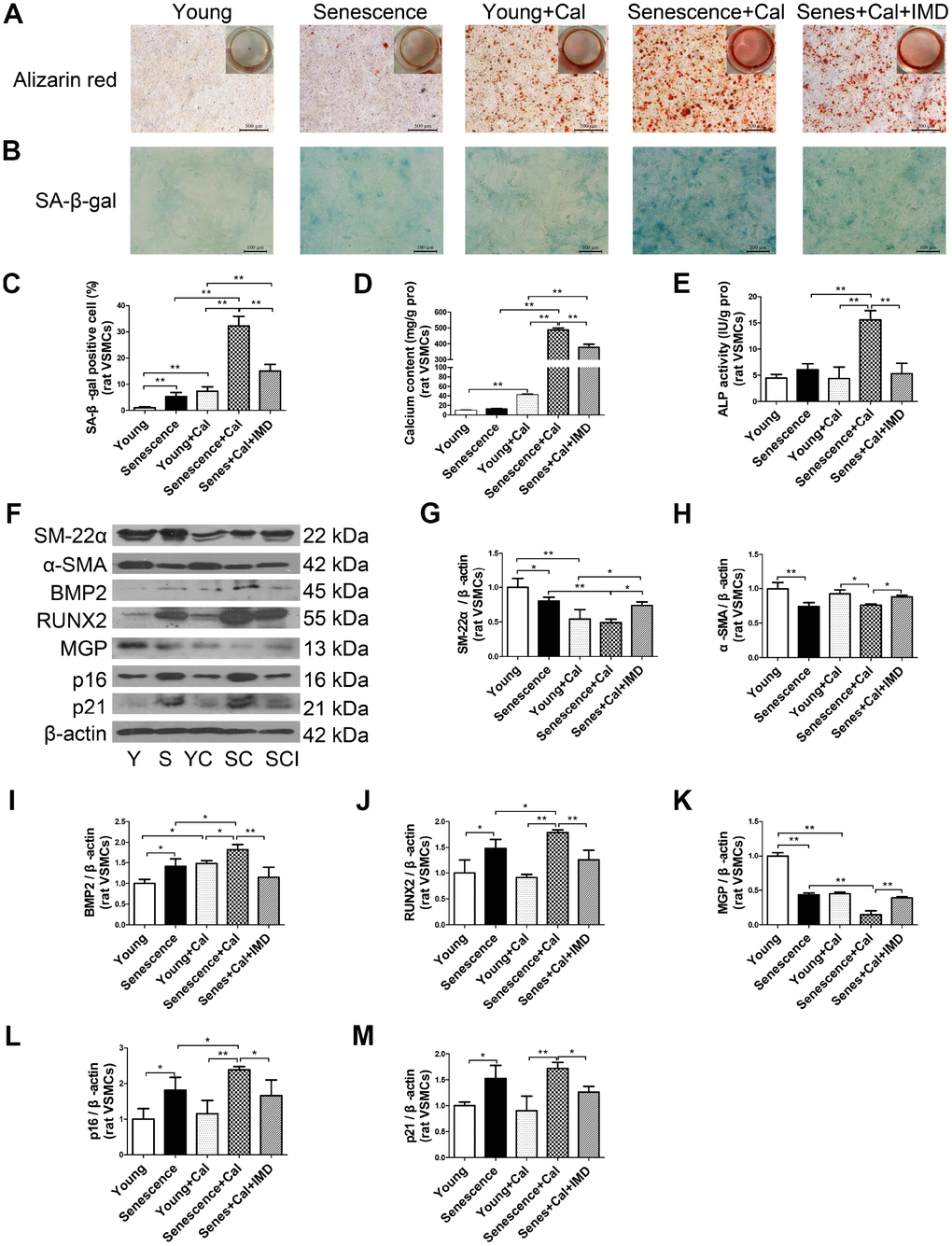 IMD1-53 inhibited senescence-associated calcification in rat VSMCs. (A) Alizarin red staining for rat VSMCs (positive staining: red) (Scale bar=500 μm). (B) SA-β-gal staining (blue) (Scale bar=100 μm) and (C) quantification of β-galactosidase-positive staining in rat VSMCs (n=6). (D) Calcium content assay (n=6) and (E) ALP activity assay (n=6) of rat VSMCs. (F) Western blot analysis of protein levels of smooth muscle 22 alpha (SM-22α), alpha smooth muscle actin (α-SMA), bone morphogenetic protein 2 (BMP2), runt-related transcription factor 2 (RUNX2), matrix γ-carboxyglutamic acid (Gla) protein (MGP), and cyclin-dependent kinase inhibitors p16 and p21 in rat VSMCs, and (G–M) quantification (n=3). Y=young VSMCs; S=senescent VSMCs; YC=young+calcification; SC=senescence+calcification; SCI=senescence+calcification+IMD1-53. Data are mean ± SD. *PP