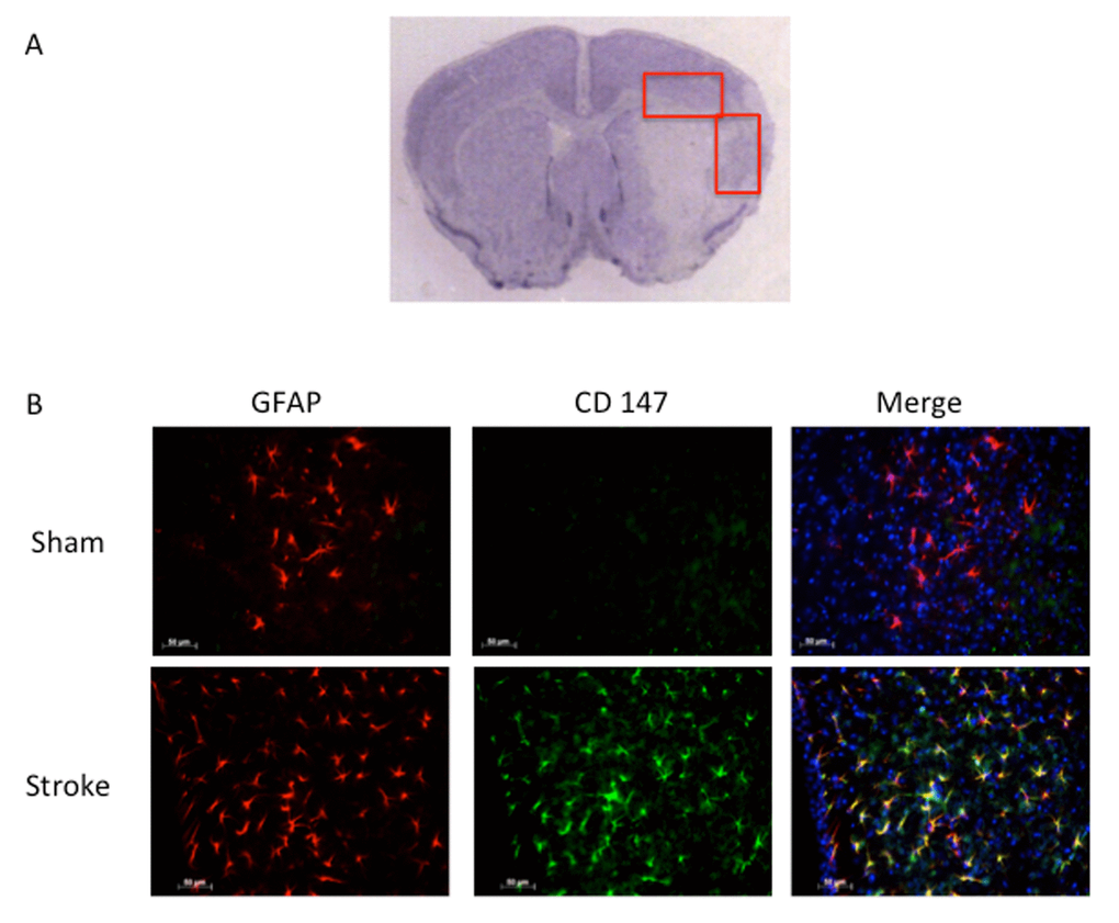 GFAP positive astrocytes co-localize with CD147. (A) Representative image of cresyl violet stained brain slice showing peri-infarct regions where imaging was performed. (B) Representative 20x IHC images of sham and stroke brain slices. CD147 co-localizes with GFAP positive astrocytes in the peri-infarct region. Pearson’s correlation coefficient 