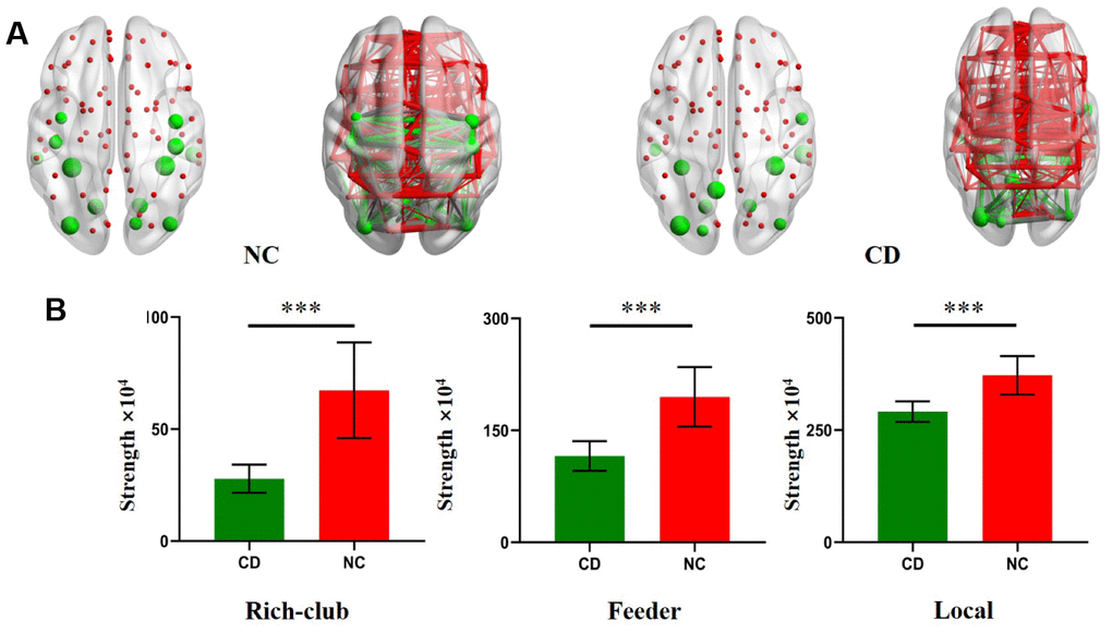 Rich Club regions distributions in CD patients and NC. (A) The hub nodes are shown with the node sizes indicating their nodal connection strength and rich club regions including the MTG.L, FFG.L, FFG.R, ITG.R, LING.L, LING.R, MOG.L, MOG.R, CUN.R, preCG.L, PreCG.R, PoCG.L, PoCG.R, SOG.L, PCUN.L, ITG.L, ROL.R. (B) The bar chart shows group differences in the rich-club, feeder, and local connection strengths. The bars and error bars represent the fitted values and the standard deviations, respectively.