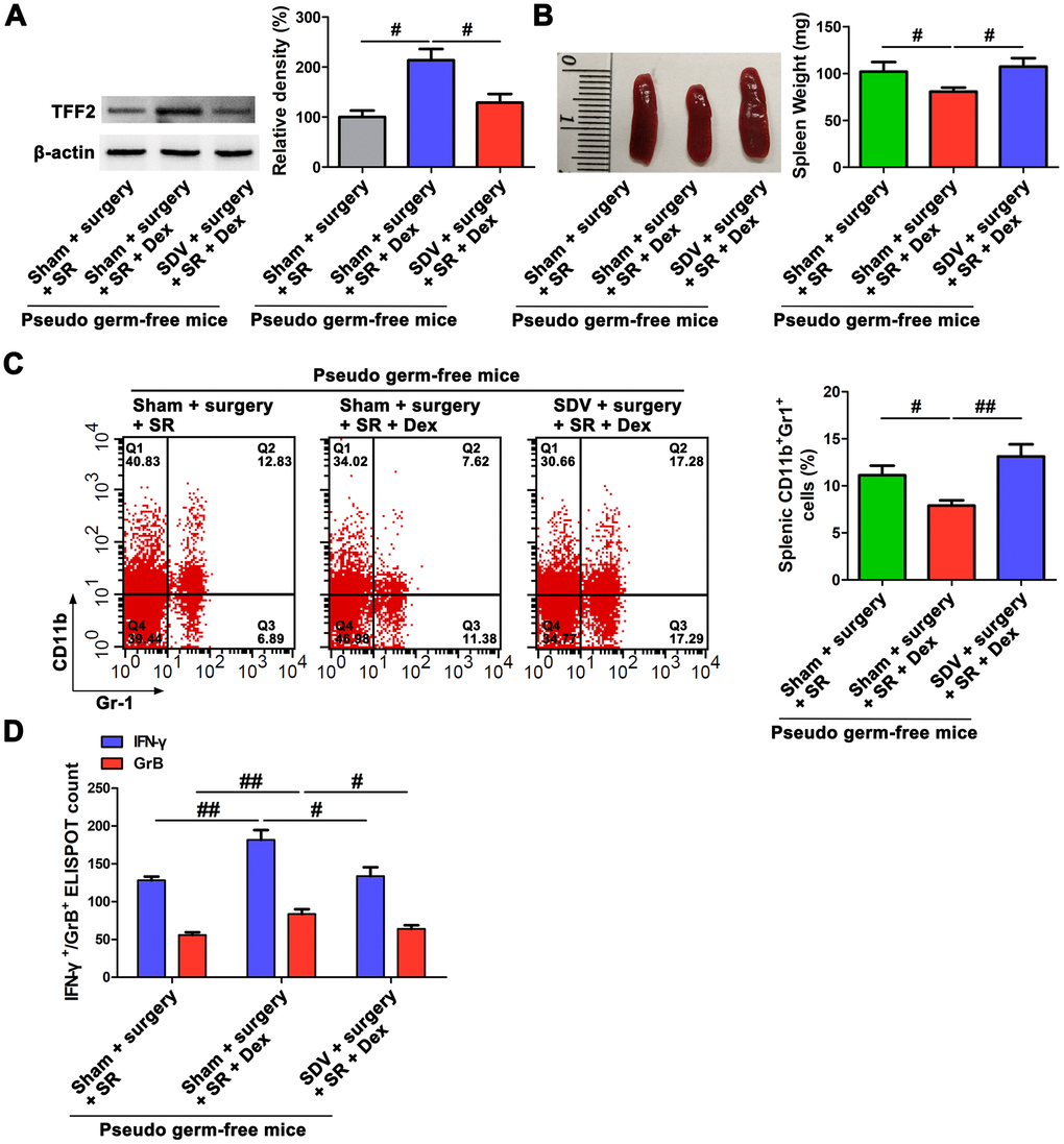 Subdiaphragmatic vagus nerve served as a bridge between gut microbiota and spleen after postoperative sleep-restriction (SR). (A) Western blotting analysis of splenic trefoil factor 2 (TFF2) expression in pseudo-germ-free mouse received fecal microbiota transplantation (FMT) with feces of SR mice, dexmedetomidine (Dex)-treated SR mice or Dex-treated SR mice with sub-diaphragmatic vagotomy (SDV). (B) Spleen weight in pseudo-germ-free mouse received FMT with feces of SR mice, Dex-treated SR mice or Dex-treated SR mice with SDV. (C) Flow cytometry analysis of spleen for CD11b+ Gr-1+ myeloid-derived suppressor cells (MDSCs) in pseudo-germ-free mouse received FMT with feces of SR mice, Dex-treated SR mice or Dex-treated SR mice with SDV. (D) The enzyme-linked immunospot (ELISPOT) assay of the levels of interferon-γ (IFN-γ) and Granzyme B (GrB) in splenic CD8+ T cells from pseudo-germ-free mouse received FMT with feces of SR mice, Dex-treated SR mice or Dex-treated SR mice with SDV. All data represent mean ± SEM, n = 5; #P ##P 