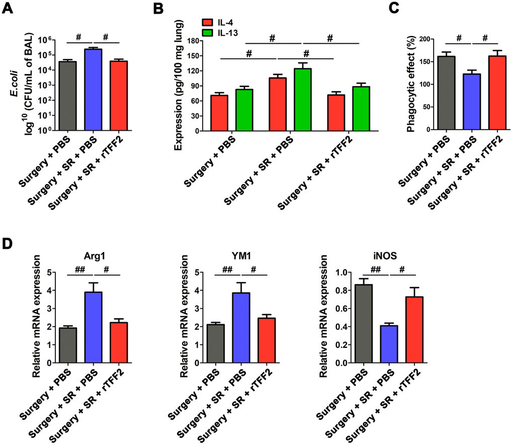 Splenic trefoil factor 2 (TFF2) was essential to attenuate SR-induced reduced protective ability against Escherichia coli (E. coli) pneumonia, increased expression of IL-4 and IL-13 in the lung and M2 polarization of alveolar macrophages (AMs), and decreased phagocytic activity of AMs. (A) Enumeration of colony-forming units (CFU) per milliliter of bronchoalveolar lavage analyzed one day after E. coli pneumonia in postoperative SR mice treated with recombinant human TFF2 protein (rTFF2) or PBS. (B) ELISA determination of the concentrations of IL-4 and IL-13 in the lungs of postoperative SR mice treated with rTFF2 or PBS one day after E. coli pneumonia. (C) The phagocytic activity of alveolar macrophages from postoperative SR mice treated with rTFF2 or PBS. (D) Real-time PCR (RT-PCR) analysis of the mRNA expression of Arg1, YM and iNOS in alveolar macrophages from postoperative SR mice treated with rTFF2 or PBS. All data represent mean ± SEM, n = 5; #P ##P 