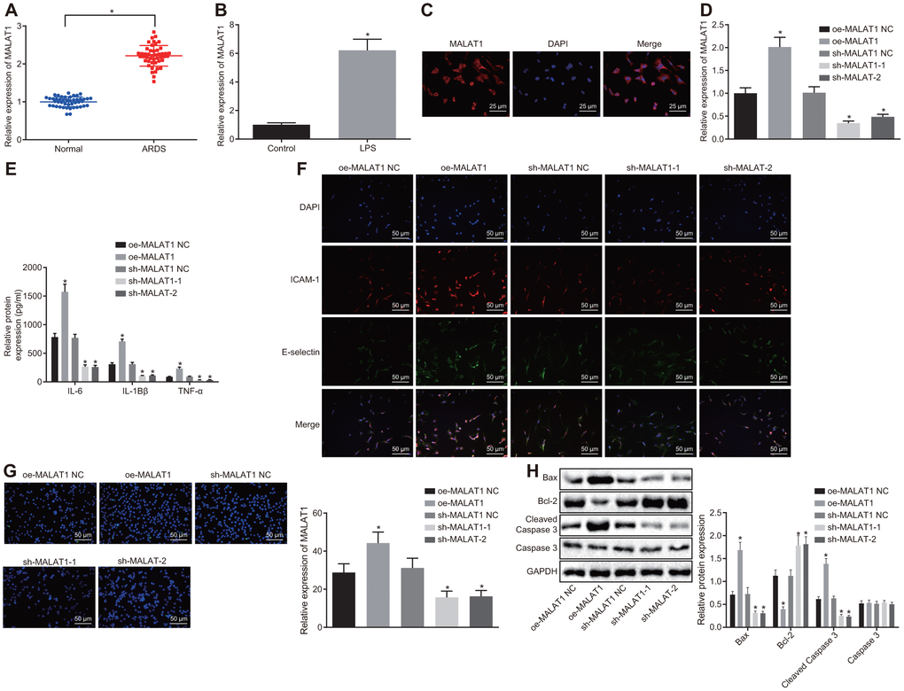 Downregulated MALAT1 inhibits apoptosis of HPMECs while decreasing the expression of pro-inflammatory cytokines and adhesion factors. (A) Expression of MALAT1 in peripheral blood samples of healthy controls (n = 46) and patients with ARDS (n = 46), as determined by RT-qPCR. * p vs. peripheral blood samples of healthy controls. (B) Expression of MALAT1 in normal and LPS-treated HPMECs, as determined by RT-qPCR. * p vs. the control cells. (C) Subcellular localization of MALAT1 in HPMECs detected by FISH (400 ×). (D) Expression of MALAT1 in HPMECs transfected with oe-MALAT1 or sh-MALAT1 determined by RT-qPCR. (E) Expression of pro-inflammatory cytokines (IL-6, IL-1β and TNF-α) in HPMECs transfected with oe-MALAT1 or sh-MALAT1 determined by ELISA. (F) Expression of endothelial cell adhesion molecules (E-selectin and ICAM-1) in HPMECs transfected with oe-MALAT1 or sh-MALAT1, as detected by immunofluorescence (× 200). (G) HPMEC apoptosis upon transfection with oe-MALAT1 or sh-MALAT1 detected by TUNEL assay (× 200). (H) Expression of Bcl-2, Bax, cleaved caspase 3 and Caspase3 in HPMECs transfected with oe-MALAT1 or sh-MALAT1 detected by Western blot analysis. * p vs. cells transfected with oe-MALAT1 NC or sh-MALAT1 NC. The data were measurement data and expressed as mean ± standard deviation. The data between two groups were compared using unpaired t-test and those among multiple groups were analyzed by one-way ANOVA, with Tukey's post hoc test. The cell experiment was repeated three times independently.