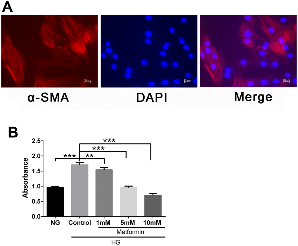 Metformin inhibited high glucose–induced vascular smooth muscle cell (VSMC) hyperplasia in a dose-dependent manner. (A) VSMC characterization by fluorescence microscopy. Expression of smooth muscle cell marker α-SMA was confirmed by red fluorescence. (B) CCK-8 evaluation of the effects of metformin on VSMC proliferation. Significant inhibition of high glucose–induced cell proliferation was found at metformin concentrations of 1, 5, and 10 mM. **p p 