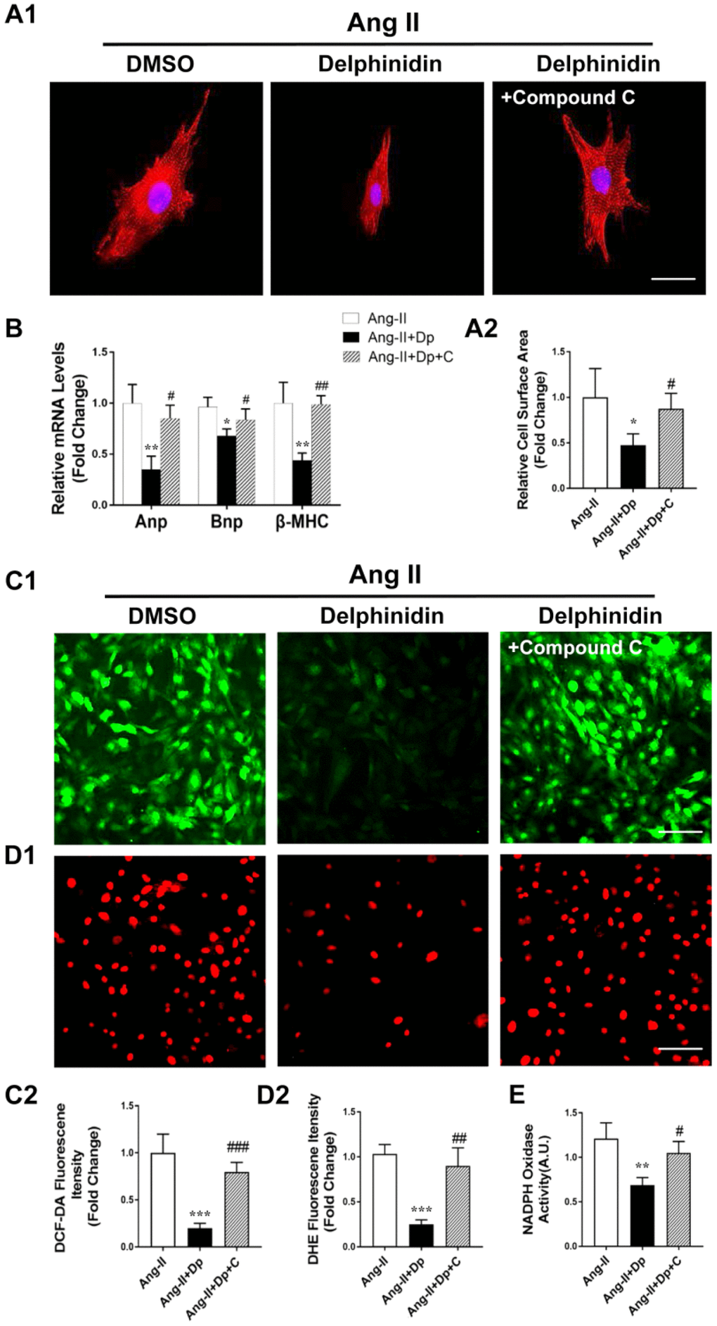 Compound C abrogated the effects of delphinidin on Ang II-induced cardiomyocyte hypertrophy and oxidative stress by blocking AMPK activity. (A) NRCMs were treated with Ang II (1 μM) for 24 hours in the presence of delphinidin (50 μM) or compound C. α-Actinin staining was performed to determine cell size. Representative images (A1) and quantified cell sizes (A2) of each group are shown (scale bar=20 μm). Cell surface areas (μm2) were measured in 3 independent experiments with at least 100 cells counted for each condition. (B) qRT-PCR was performed to analyze the expression of hypertrophic genes. (C, D), Representative image and quantitative analysis of ROS generation measured by DCF-DA and DHE staining. (E) Statistical analysis of differences in nicotinamide adenine dinucleotide phosphate (NADPH) oxidase activity. A.U., arbitrary units. In A–E, *p versus the Ang II group; **p versus the Ang II group; ***p versus the Ang II group; #p versus the Ang II+Dp group; ##p versus the Ang II+Dp group; ###p