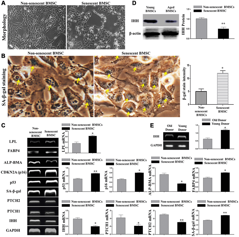 IHH signaling pathway downregulated in aged BMSC. (A) Morphology of non-senescent and senescent BMSC. (B) Non-senescent and senescent BMSC stained by SA-β-gal stain. (C) BMSC (n = 4) were incubated with or without senescence-induction medium for 8 days. IHH, PTCH1/2, SA-β-gal, p53, p16, ALP-BMA, FABP4, and LPL genes expressions were measured by RT-PCR. GAPDH was used as a housekeeping gene. (D) Isolated BMSC (n = 4) were incubated with or without senescence-induction medium for 8 days. IHH protein expression was measured by Western Blot. β-actin was used as an internal control. (E) Isolated BMSC from young and old donors (n = 4) were analyzed for IHH gene expression by RT-PCR. GAPDH was used as a housekeeping gene. Results presented as mean ± SEM. *P 