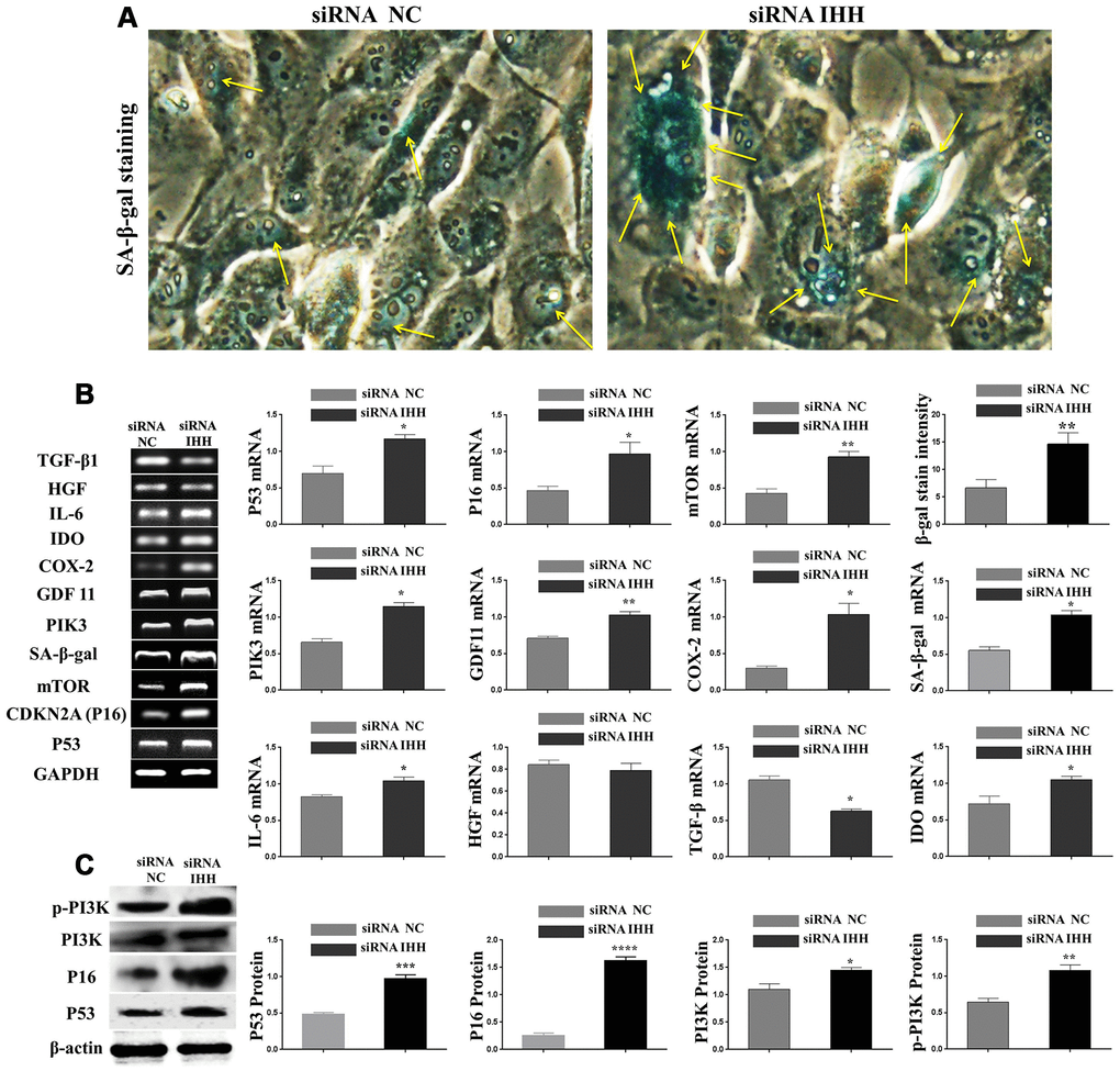 IHH knockdown induced BMSC senescence. (A) BMSC transfected with NC siRNA and IHH siRNA stained by SA-β-gal stain. (B) BMSC (n = 5) were transfected with siRNA negative control or siRNA IHH for 24hours. TP53, CDKN2A, SA-β-gal, mTOR, PIK3, GDF11, COX-2, IDO1, IL-6, HGF, and TGFβ genes expressions were measured by RT-PCR. GAPDH was used as a housekeeping gene. (C) BMSC (n = 5) were transfected with siRNA negative control or siRNA IHH for 48hours. P53, P16, PI3K, and p-PI3K proteins expressions were measured by Western Blot. β-actin was used as an internal control. Results presented as mean ± SEM. *P 