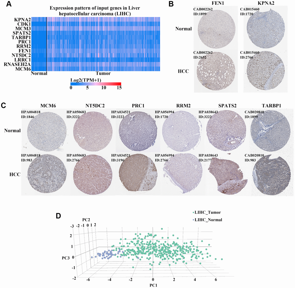 Verification of the expression of 12 hub genes in HCC. (A) Heatmaps of the levels of 12 hub genes comparing HCC and normal liver tissues in the TCGA cohort. Red and blue colors indicate higher and lower expression, respectively. (B–C) Eight hub genes were upregulated in HCC compared to expression in normal tissues based on immunohistochemical staining analysis of the Human Protein Atlas database. Antibody numbers and patient/healthy control ID numbers were annotated. (D) Three-dimensional (3D) principle component analysis (PCA) score plot showing that HCC patients can be effectively distinguished from healthy controls based on the expression of these 12 genes.