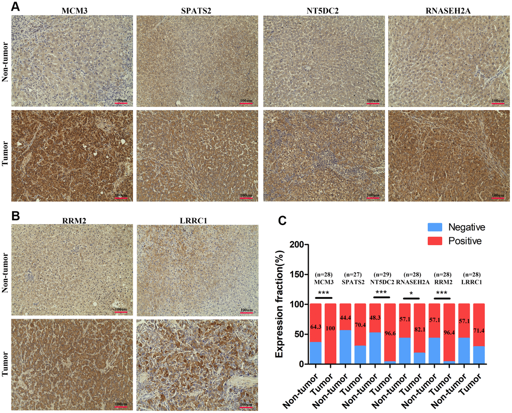 The expression levels of MCM3, SPATS2, NT5DC2, RNASEH2A, LRRC1, and RRM2 in HCC tissues. (A–B) Immunohistochemical staining analysed expression levels of MCM3, SPATS2, NT5DC2, RNASEH2A, LRRC1, and RRM2 in HCC and non-tumor tissues. (C) Positive expression percentage of the six genes in HCC and non-tumor tissues was showed. Fewer than 30 samples due to de-fragmentation. *P P P 