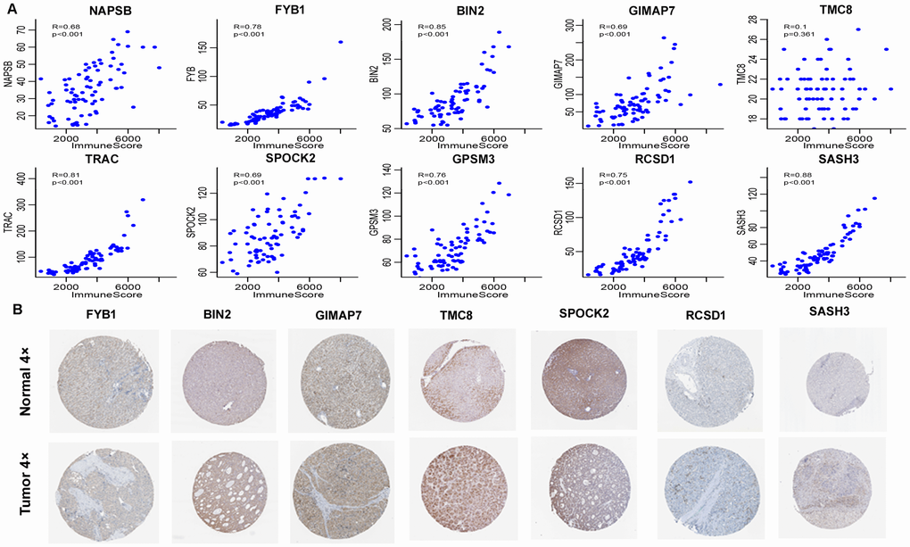 External validation of 12 immune-related genes. (A) Pearson correlation of expression and ImmuneScore using GSE62232 dataset. TRBC2 and TRBV28 were not detected. 9 genes, except TMC8, had significant correlation. Y-axis represented expression level of the genes in each sample. (B) Representative immunohistochemical staining images of 7 genes in normal liver tissue and HCC specimen. Images were taken from the Human Protein Atlas (https://www.proteinatlas.org). TMC8 was strongly positive, BIN2, GIMAP7, SPOCK2 were moderately positive, and FYB1, RCSD1, SASH3 were weakly positive in HCC tissues relative to their expression levels in normal liver tissues.