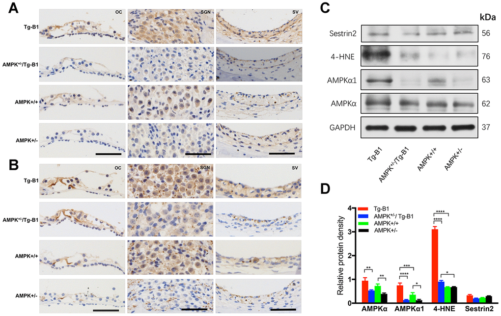 Expression of AMPK and p-AMPK, quantification of ROS and antioxidant protein in the cochlear tissues. (A–B) The representative mid-modiolar immunohistochemistry staining of cross-sections of the cochlea for the expressions of total AMPKα1 and p-AMPKα in three regions of the cochlea: OC (left column), SGN (middle column) and SV (right column). Increased DAB-stained immunolabeling of AMPKα1 and p-AMPKα (brown) in the cytosol and nuclei of OHCs, IHCs, OC, SGNs, basal cells of the SV were observed in the cochlear sections of Tg-B1 mice than those in AMPK+/−/Tg-B1 and WT mice. There was strong immunolabeling for p-AMPKα in the OC, SGNs, and SV of Tg-B1 mice, while AMPK+/− showed the weakest immunolabeling signals. Scale bar=50 μm. (C) Western blot using sensory epithelium tissues from 10-12 months mice displayed significant alteration in band density for total AMPKα, AMPKα1, and 4-HNE in the cochleae between Tg-B1 and AMPK+/−/Tg-B1 mice, but no significant difference in Sestrin2 expression, the antioxidant protein. GAPDH served as the loading control. (D) Histograms (mean ± SEM) represent relative density values normalized to GAPDH. Blotting results of AMPKα1 showed knockouts of AMPKα1 in Tg-B1 mice significantly decreased the AMPKα1 (p