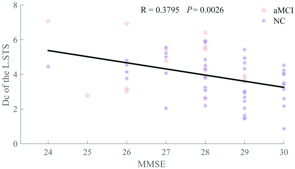 Relationship between Dc of the L.STS and MMSE. The patient group is indicated by the Indian red pentagrams and the normal group by dark orchid asterisks.