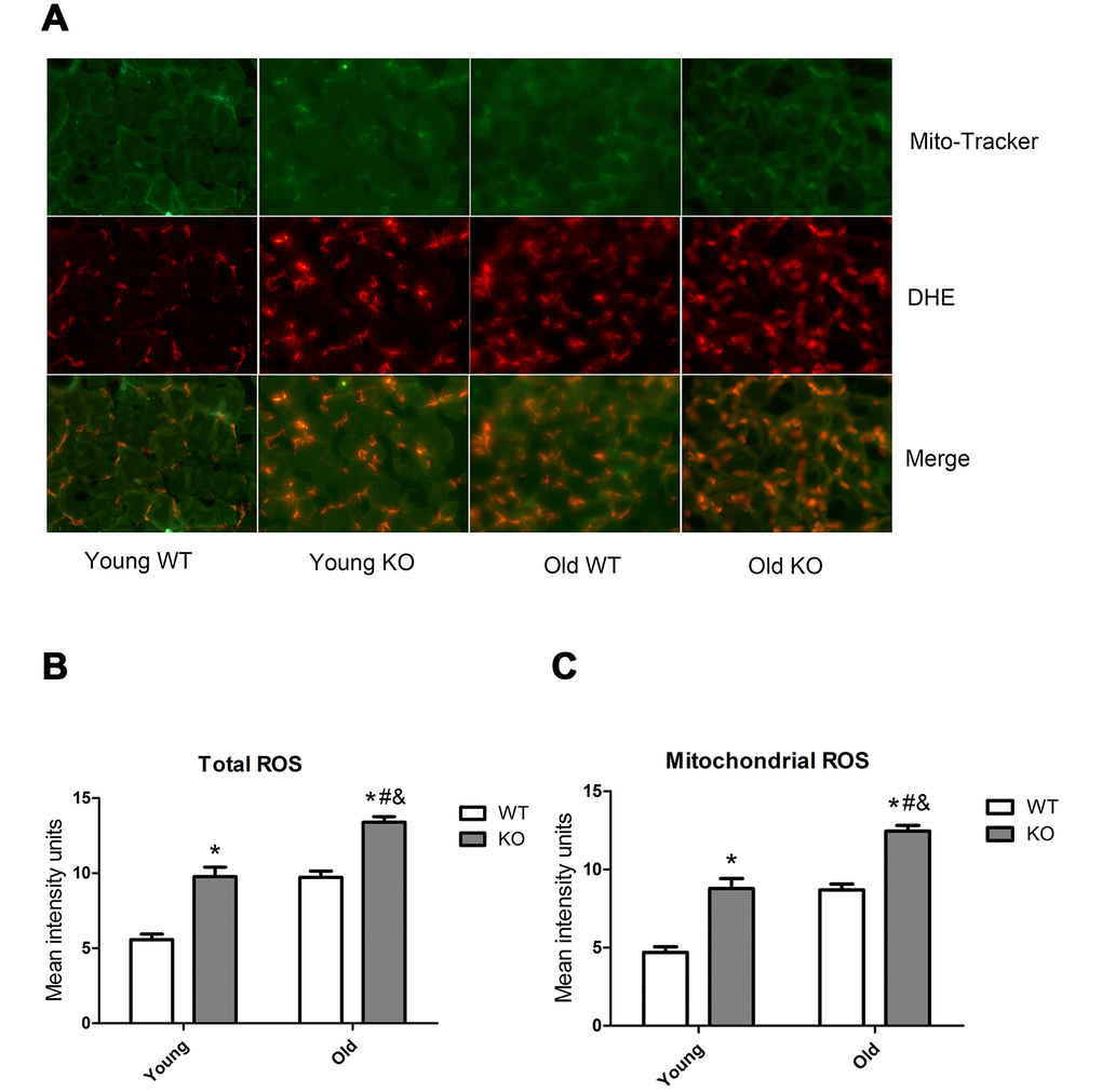 ROS level in skeletal muscle of different groups. (A) Mito-Tracker green is a marker of mitochondria, dihydroethidium (DHE) is a probe of reactive oxygen species (ROS). Images from green and red fluorescence were merged (yellow) to locate the mitochondrial source of ROS generation. The yellow color indicates ROS within the mitochondria. (B) Total ROS. (C) Mitochondrial ROS. Data represent mean ± SE, n=3. #P 