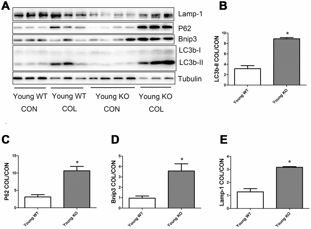 Autophagy flux in skeletal muscle of young WT and young KO mice. (A) Western blot images. (B–E) Statistical graphs. Data represent mean ± SE, n=3-4. *statistically significant.