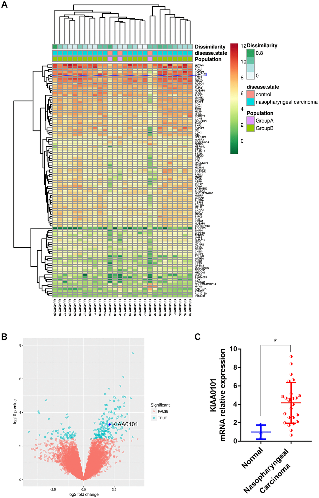 Top ranked and highly expressed KIAA0101 in nasopharyngeal carcinoma dataset GDS3610. (A) Heatmap showing top 100 ranking genes, based on GeoDiver analysis. (B) Volcano plot of differential gene expressions; KIAA0101 was marked by dark blue circle. (C) Relative mRNA expression of KIAA0101 in GDS3610. *P