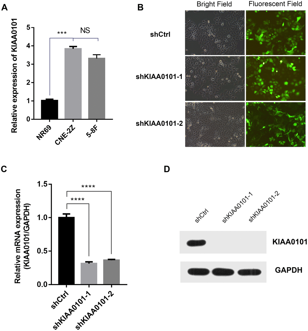 Lentivirus mediated KIAA0101 downregulation is effective in NPCs. (A) The mRNA expression level of KIAA0101 was detected with qRT-PCR in two NPC cells. Histogram is the average value (mean ± SD) of three independent experiments. (B) Representative bright field and fluorescent field graphs of CNE-2Z cells infected with two indicated lentiviruses are shown by GFP. The mRNA (C) and protein (D) levels of KIAA0101 were measured by qRT-PCR and Western blotting in CNE-2Z cells after lentivirus infections. All were done at least three independent experiments. ****P