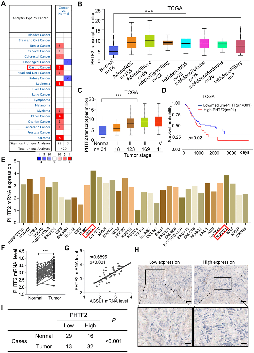 PHTF2 was significantly up-regulated in gastric cancer. (A) Expression pattern of PHTF2 in differential human malignancies from “Oncomine” database. (B) PHTF2 was significantly up-regulated in different histological subtypes of gastric cancer. (C) PHTF2 mRNA expressed in four different stages of cancerous tissues compared to para-cancerous tissues based on TCGA gastric cancer dataset. (D) Overall survival of patients with gastric cancer was calculated using Kaplan–Meier analysis according to the PHTF2 mRNA expression lever. (E) PHTF2 is commonly up-regulated in various gastric cancer cell lines from CCLE database. (F) PHTF2 mRNA expression pattern in 50 pairs of human gastric cancer tissues (Cancer) and adjacent tissues (Normal). (G) The expression pattern of ACSL1 and PHTF2 was associated in gastric cancer tissues. (H) Representative IHC image show PHTF2 protein expression pattern in gastric cancer tissues. (I) Different distribution of PHTF2 was statistically analyzed with Chi-square test.