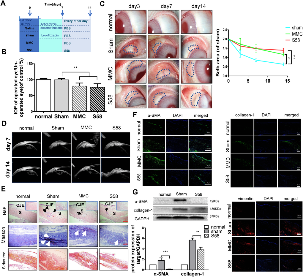 S58 treatment prolongs the survival of filtering blebs after GFS in rabbits. (A) Animal model establishment and postoperative model of administration. (B) IOPs of the operated and non-operated eyes were measured. The numbers indicated the mean IOP percentage of the control group (n=5). (C) Representative stereo-microscopic images showing bleb characteristics in different groups of rabbits’ eyes (the area of blebs is outlined by dotted blue lines) at day 3, 7, and 14 after GFS, and quantization of bleb area. (D) UBM imaging of the rabbits’ conjunctiva confirmed bleb survival. (E) Representative images of H&E (shown by black arrow), Masson’s trichrome staining (as white arrow showed) and Sirius Red staining (n=5). (F) Representative images showing immunohistochemical staining for α-SMA, vimentin, and collagen-1 in rabbits’ ocular tissue sections, collected at day 14 after GFS. (Nuclei = blue, vimentin = red, and α-SMA/ collagen-1= green). (G) Fibrotic protein levels of α-SMA/collagen-1 was examined by western blotting. GAPDH was used as loading control. n = 3. Data indicate the mean ± SD. *p 