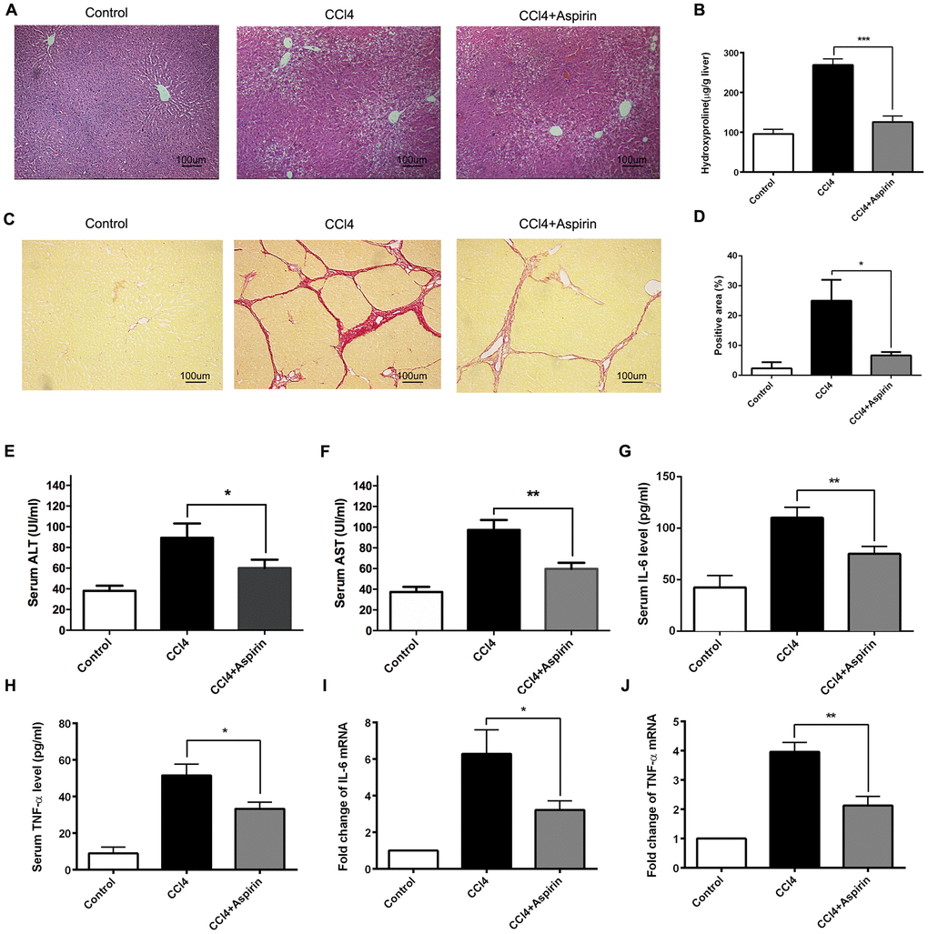 Aspirin rehabilitated CCl4-induced liver fibrosis and inflammation in rat. (A) Liver fibrosis was detected 6 weeks after CCl4 treatment by HE. (×200; scale bar: 100μm) (B) Hepatic hydroxyproline content was measured 6 weeks after CCl4 treatment. (C, D) Hepatic fibrosis was examined by Sirius red staining. (×200; scale bar: 100μm) (E, F) The AST and ALT were detected to assess the liver function. (G–J) The levels of inflammatory cytokines (IL-6 and TNF-α) in serum and liver tissues were measured by ELISA and real-time PCR. *P**P