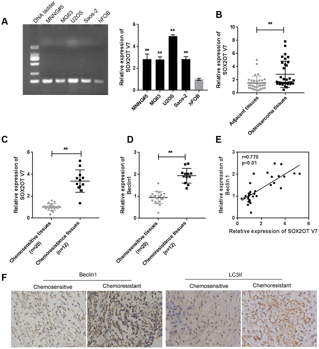 Expression of Sox2OT-V7 in tissue samples and cell lines and its correlation with autophagy markers. (A) Sox2OT-V7 expression in four OS cell lines and a normal osteoblast cell line was determined by qPCR. (B) Sox2OT-V7 expression in 32 paired OS and nontumorous tissue samples was determined by qPCR. (C, D) Sox2OT-V7, and Beclin 1 expression in 20 chemosensitive and 12 chemoresistant OS tissues was determined by qPCR. (E) The correlation Sox2OT-V7 and Beclin 1 mRNA expression in tissue samples was analyzed by Pearson’s correlation analysis. (F) The protein content and localization of Beclin 1 and LC3II in tissue samples was revealed by IHC staining. The data are presented as mean ± SD of three independent experiments. *PP
