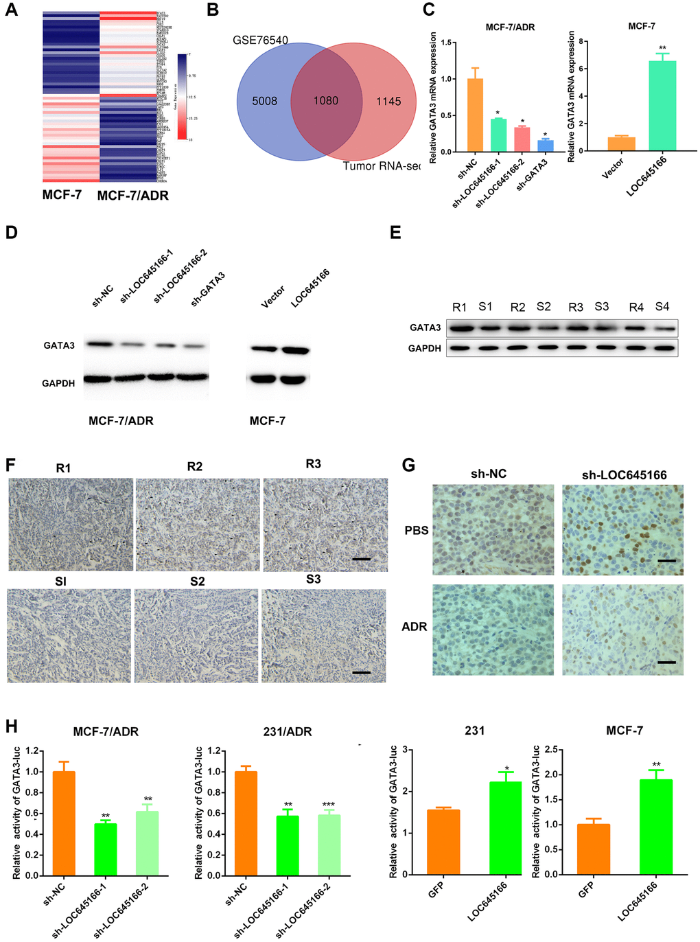  lnc-LOC645166 promotes adriamycin resistance by activating GATA3. (A) A heatmap of top ADR-resistant genes. (B) Common ADR-resistant genes by microarray and GEO database were selected as potential target genes. (C) RT–qPCR analysis of GATA3 when lnc-LOC645166 was silenced or overexpressed. (D) Western blots analysis of the GATA3 when lnc-LOC645166 was silenced or overexpressed. (E) Western blots analysis of the GATA3 protein in tumors derived from adriamycin resistance and sensitive patients. R means the resistance, S means sensitive. (F) Representative immunostaining of GATA3 in an independent set of tumor samples with good or poor responses to adriamycin therapy. R means resistant to ADR therapy, S means sensitive to ADR therapy. Scale bar=100 μm (G) Representative immunostaining of GATA3 in the transplanted tumors. Scale bar=50μm. (H) Luciferase activity assay of GATA3 luciferase reporter plasmids in breast cancer cells when lnc-LOC645166 was knockdown or overexpressed. The data represented the mean±SD of three independent experiments. *P