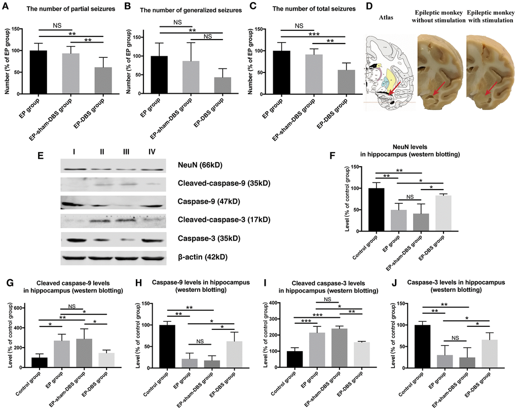 ANT-DBS reduced seizures frequency and relieved hippocampal neurons apoptosis in the epileptic monkeys. (A–C) Numbers of seizures in the different groups. The numbers of partial and total seizures were reduced by ANT-DBS, compared with the EP and EP-sham-DBS groups. Although there was no significant difference in the number of generalized seizures between EP-sham-DBS and EP-DBS groups (P > 0.05), there was still a trend of reduction. (n=6 in each group) (D) Morphology of hippocampus in monkeys receiving ANT-DBS was not affected and there was no obvious atrophy. Red arrows indicate the location of the hippocampus in the atlas of the rhesus monkey brain. (E) Analysis of NeuN, cleaved-caspase-3 caspase-3, cleaved-caspase-9 and caspase-9 by western blotting. (F–J) There were marked decrease in NeuN level and increase in cleaved-caspase-3 and cleaved-caspase-9 levels in EP and EP-sham-DBS groups. Increased NeuN and reduced cleaved-caspase-3 and cleaved-caspase-9 levels were detected after ANT-DBS. (n=3 in each group) *PPPP> 0.05. Data were presented as mean ± SD. I, control group; II, EP group; III, EP-sham-DBS group; IV, EP-DBS group.