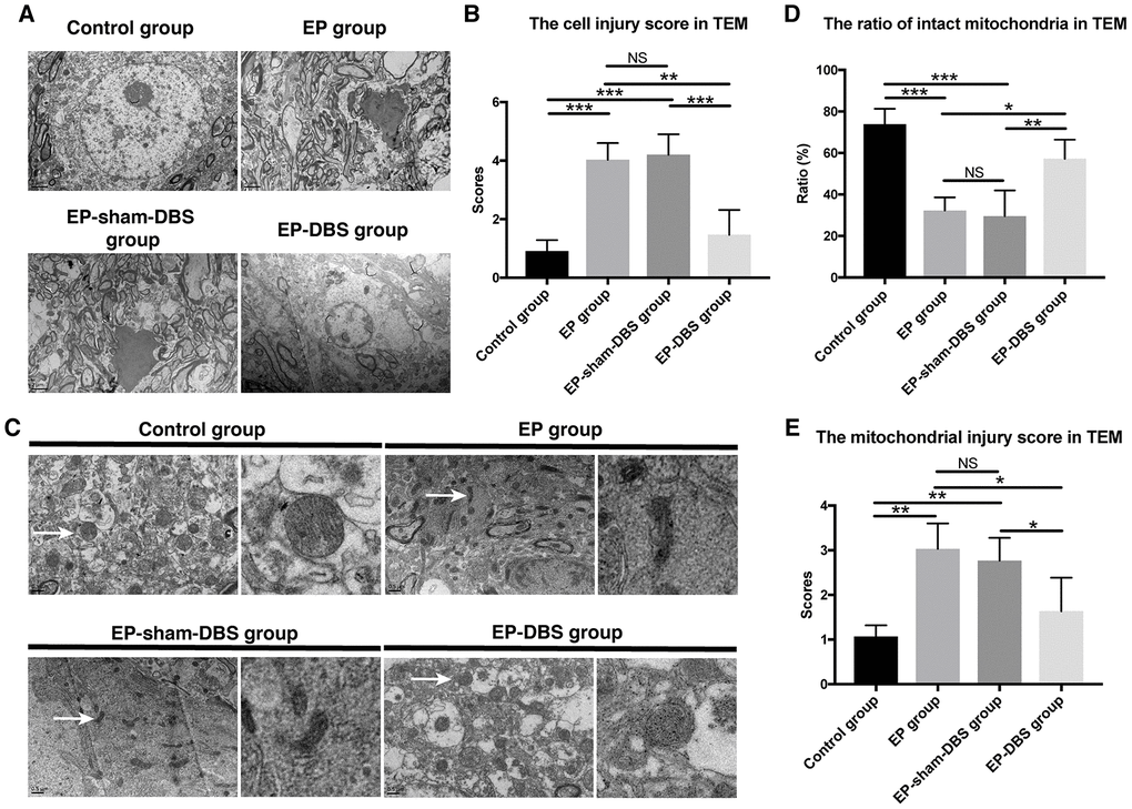 ANT-DBS protected hippocampal neurons of the epileptic monkeys. (A) Neuronal ultrastructure by TEM. The injury was severe in the hippocampus of EP and EP-sham-DBS groups. The injury, however, was relieved by ANT-DBS. Magnification: ×1000. (B) Higher injury grades were obtained in the EP and EP-sham-DBS groups, and this grade was alleviated by ANT-DBS. (n=3 in each group; in each monkey, twenty cells were randomly selected, and the average score for each monkey was recorded) (C) Morphology of mitochondria (white arrow) by TEM. Normal or slightly abnormal morphology of mitochondria was seen in the control and EP-DBS groups. The EP and EP-sham-DBS groups showed swelling of the mitochondrial matrix, sometimes with disrupted membrane integrity. Magnification: ×3000. The right column shows a closer view of mitochondria. (D) The number of intact mitochondria in the EP and EP-sham-DBS groups was lower than that in the control and EP-DBS groups. (n=3 in each group; in each monkey, twenty fields were randomly selected, and the average number for each monkey was recorded) (E) The grade of mitochondrial injury was higher in the EP and EP-sham-DBS groups, and reversed by ANT-DBS (n=3 in each group; in each monkey, twenty cells were randomly selected, and the average grade for each monkey was recorded). *PPPP> 0.05. Data were presented as mean ± SD.