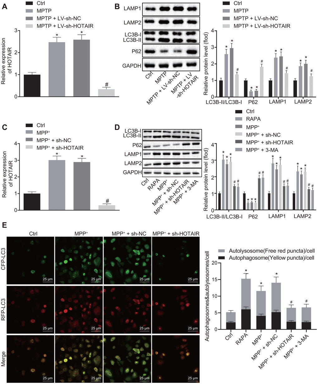 HOTAIR depletion represses autophagy in dopaminergic neurons in SNc tissues of PD mice. The expression patterns of HOTAIR in SNc tissues measured by RT-qPCR (n = 10), *p vs. mice injected with saline; #p vs. mice injected with MPTP + LV-sh-NC. (A) The ratios of LC3B-I/LC3B-II and LAMP1/LAMP2 along with the P62 expression patterns in SNc tissues determined by Western blot analysis (n = 10), *p vs. mice injected with saline; #p vs. mice injected with MPTP + LV-sh-NC. (B) The expression patterns of HOTAIR in MN9D cells treated with PBS, MPP+, MPP+ + sh-NC and MPP+ + sh-HOTAIR measured by RT-qPCR, *p vs. MN9D cells treated with PBS; #p vs. MN9D cells treated with MPP+ + sh-NC. (C) The ratios of LC3B-I/LC3B-II and LAMP1/LAMP2 along with the P62 expression patterns in MN9D cells treated with PBS, RAPA, MPP+, MPP+ + sh-NC and MPP+ + sh-HOTAIR assessed by Western blot analysis, *p vs. MN9D cells treated with PBS; #p vs. MN9D cells treated with MPP+ + sh-NC. (D) Detection of autophagy levels in MN9D cells by co-localization analysis. (E) Data (mean ± standard deviation) among multiple groups were analyzed using one-way ANOVA and subjected to Tukey’s post-hoc test. The experiment was repeated three times. HOTAIR, HOX transcript antisense intergenic RNA; SNc, substantia nigra compact; PD, Parkinson’s disease; RT-qPCR, reverse transcription quantitative polymerase chain reaction; PBS, phosphate buffered saline; MPP+, 1-methyl-4-phenylpyridinium; NC, negative control; ANOVA, analysis of variance; MPTP, 1-methyl-4-phenyl-1,2,3,6-tetrahydropyrindine.