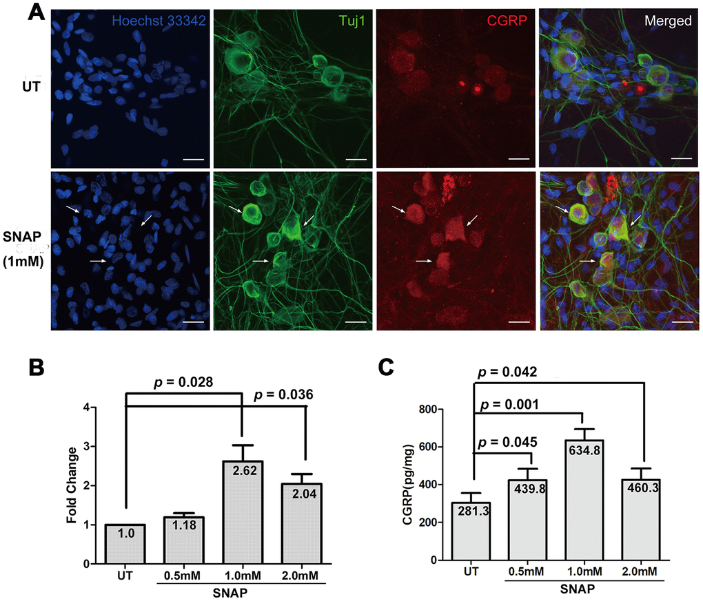 SNAP induces CGRP expression and production in TGNs. Primary TGNs isolated from 3-day-old Wistar rats (n = 9) were cultured as described in Materials and Methods and subjected to the experiments as follows. (A) Cells were treated with 1.0 mM SNAP for 2 h, followed by culture in NB medium without SNAP for an additional 24 h, after which cells were fixed with 4% paraformaldehyde. Double immunofluorescent staining was then performed using primary antibodies against CGRP (red) and Tuj1 (green, a marker of neurons). Cells were counterstained with Heochst33342 (blue) for nuclei. Scale bar = 20 μm. Arrows indicate representative neurons with increased expression of CGRP. (B) Cells were treated with the indicated concentrations of SNAP for 2 h, followed by culture in NB medium without SNAP for an additional 24 h, after which qPCR was performed to monitor the mRNA levels of CGRP. (C) In parallel, ELISA was conducted to determine the amount of CGRP protein in culture medium.