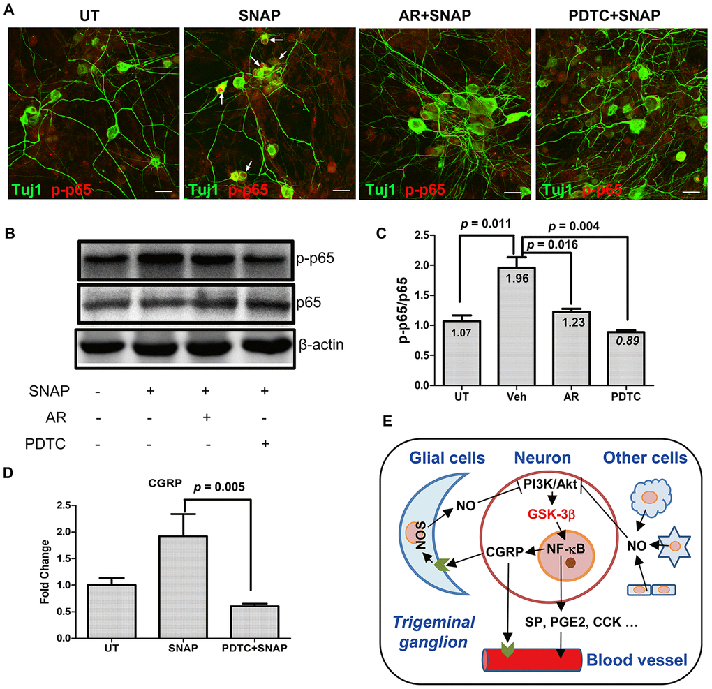 GSK-3β inhibition blocks NF-κB activation in TGNs exposed to SNAP, preventing SNAP-induced CGRP expression. (A–C) Cultured primary cells were pre-treated with 10 μM AR-A014418 or the NF-κB inhibitor PDTC (50 μM) for 30 min, and then exposed to 1.0 mM SNAP for 2 h. After culturing in inhibitor- and SNAP-free medium for an additional 24 h, cells were fixed with 4% paraformaldehyde and double stained with primary antibodies against phosphorylated p65 (red fluorescence) and Tuj1 (green). Scale bar = 20 μm. Arrows indicate representative Tuj1-positive neurons expressing high levels of phosphorylated p65 in the nuclei (A). In parallel, Western blotting was performed to monitor total and phosphorylated p65 in cells (B). The blots were quantified to calculate the ratio of phosphorylated vs total p65 (C). (D) In addition, cells were treated with SNAP in the absence or presence of PDTC, after which qPCR was performed to monitor the expression of CGRP in cells. (E) A potential model for the mechanism by which NO induces the release of CGPR and other migraine-related factors. Briefly, NO released from glial cells and other types of cells in trigeminal ganglion acts to activate GSK-3β (likely due to inhibition of the PI3K/Akt pathway), which in turn activates NF-κB, thereby inducing the expression and production of CGRP as well as other pain-related factors (e.g., SP, PGE2, CCK, etc.) in TGNs. As a consequence, those factors (particularly CGRP) cause or worsen headache attacks in patients with migraine. Along with previous findings that CGRP released from TGNs may enhance NO production by glial cells, our observations support a positive feedback loop between CGRP and NO in communication between neurons and glial cells.