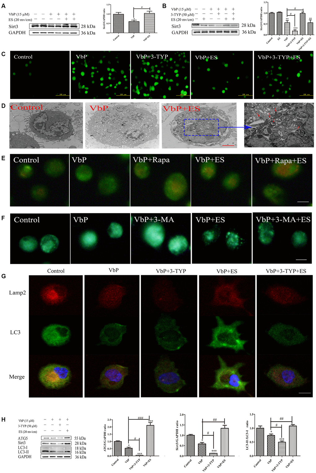 ES rescues Sirt3 expression to induce autophagy in VbP-treated THP-1 macrophages. (A) Western blot analysis of Sirt3 expression in macrophages treated with VbP and ES. (B) Analysis of the effects of ES and the Sirt3 inhibitor 3-TYP on Sirt3 expression. (C) DCFH-DA staining showing the effect of 3-TYP on ROS generation by macrophages (scale bar: 100 μm). (D) TEM images showing autophagosome assembly (red arrows) in VbP-treated macrophages exposed to ES (scale bar: 10 μm). (E) Visualization of AVOs by AO staining. The autophagy inducer Rapa (1 μM) was used as positive control. (F) DMC staining showing induction of autophagic vacuoles by ES in VbP-treated macrophages. This effect was blocked by pre-treatment with the autophagy inhibitor 3-MA (10 mM) (scale bar: 50 μm). (G) Immunofluorescence analysis of LC3 and Lamp2 expression indicating induction of autolysosome formation by ES and inhibition of this process by 3-TYP in VbP-treated macrophages (scale bar: 20 μm). (H) Western blotting analysis of the effects of ES and 3-TYP on ATG5, Sirt3, and LC3 expression in VbP-treated macrophages. n = 3; *P#P##P###P