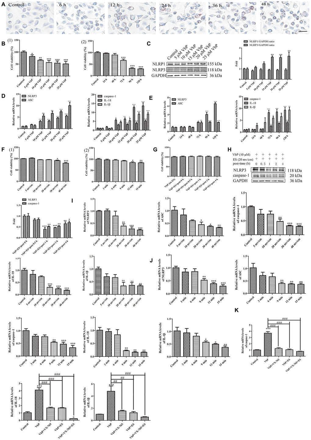 ES inhibits VbP-induced pyroptosis in foam cells. (A) Representative images of Oil Red O-stained THP-1 macrophages following incubation with ox-LDL for 6, 12, 24, and 48 h (scale bar: 50 μm). (B) Detection of foam cell viability by CCK8 assays: (1) Dose-response assay results (72 h incubation); (2) Time-response assay results (5 μM VbP). (C) Detection of NLRP1 and NLRP3 expression by western blotting in foam cells treated with different concentrations of VbP (72 h exposure). (D) Dose-response and (E) time-response RT-qPCR analysis of pyroptosis-related mRNAs in foam cells treated with different concentrations of VbP (72 h) or 10 μM VbP for up to 120 h. (F) Viability measurements in VbP-treated foam cells exposed to ES at (1) different voltages (9 min exposure) and (2) 20 mv/cm for various exposure times. (G) Viability measurements at different time points after ES (20 mv/cm for 9 min) in foam cells treated with VbP (10 μM for 72 h). (H) Analysis of NLRP3 and caspase-1 expression by western blotting at different time points after 9 min, 20 mv/cm ES. (I) Dose-response and (J) time-response RT-qPCR analysis of pyroptosis-related mRNAs in foam cells exposed to ES. (K) RT-qPCR analysis showing the effects of VbP, VX-765, and ES on caspase-1, IL-18, and IL-1β mRNA levels in foam cells. n = 3; *P##P###P