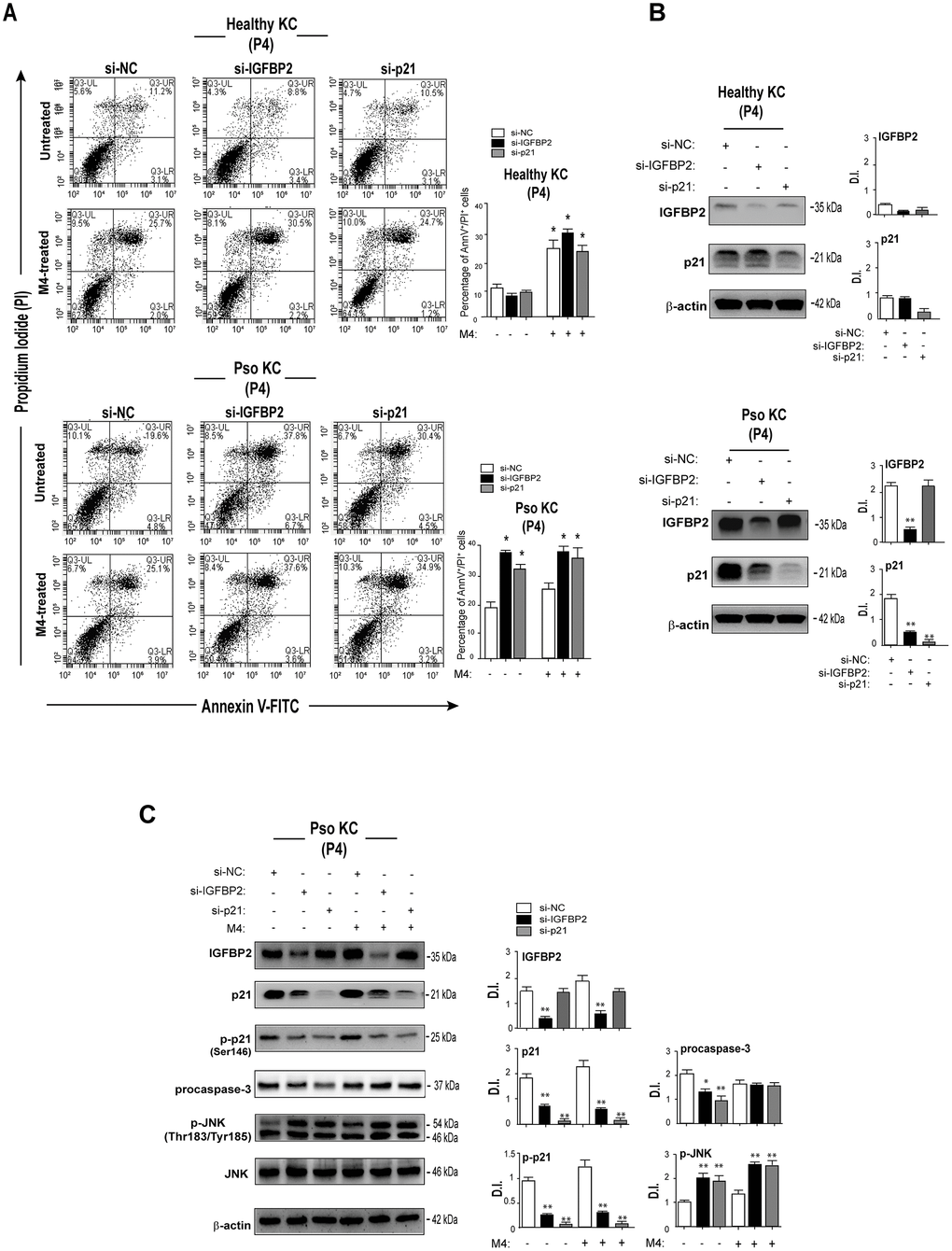 IGFBP2 suppression leads to enhanced apoptosis of senescent psoriatic keratinocytes. (A) Pso KC and healthy KC cultures at passage P4 were silenced or not for IGFBP2 or p21 for 48 hours, and treated or not with M4 for 24 hours. Apoptosis was examined by measuring Annexin V/PI fluorescent staining through FACS analysis. Graphs show the mean ± SD of the percentage of AnnV/PI double-positive cells of three independent experiments. *p ≤ 0.05, as calculated by paired Student’s t test comparing si-IGFBP2 or si-p21 with si-NC, or untreated with M4. (B) Protein lysates of untreated healthy KC and pso KC, silenced or not for IGFBP2 or p21, were analysed by WB to confirm IGFBP2 or p21 silencing. Graphs show the mean ± SD of densitometric intensity (D.I.) of three independent experiments. *p ≤ 0.05, **p ≤ 0.01 as calculated by paired Student’s t test comparing si-IGFBP2 or si-p21 with si-NC. (C) Protein extracts of pso KC at passage 4, silenced or not for IGFBP2, or p21 for 48 hours, and stimulated or not with M4 for 24 hours, were subjected to WB for the detection of IGFBP2, p21, p-p21, procaspase 3, p-JNK and JNK protein expression. WB panels are representative of three independent experiments and graphs show the mean ± SD of densitometric intensity (D.I.) of three independent experiments. *p ≤ 0.05, **p ≤ 0.01 as calculated by paired Student’s t test comparing si-IGFBP2 or si-p21 with si-NC.